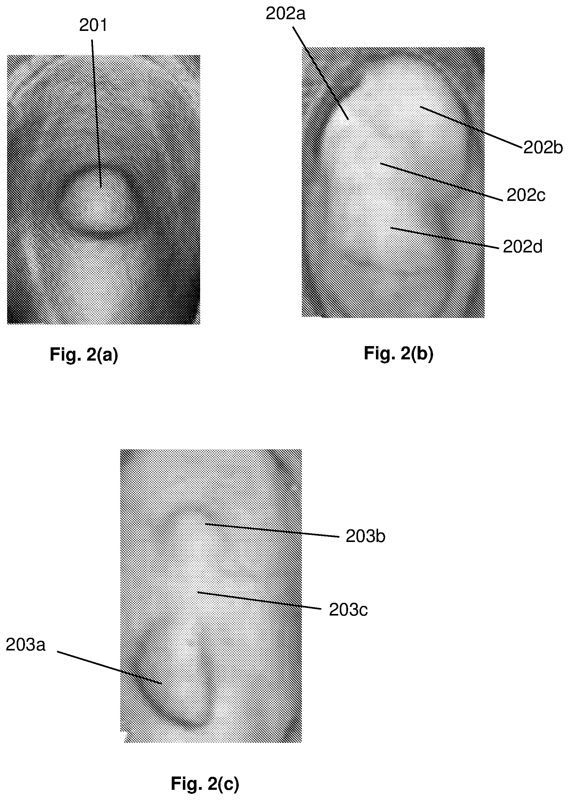 Patent US12165309 Figure 2 – Deformity edge detection