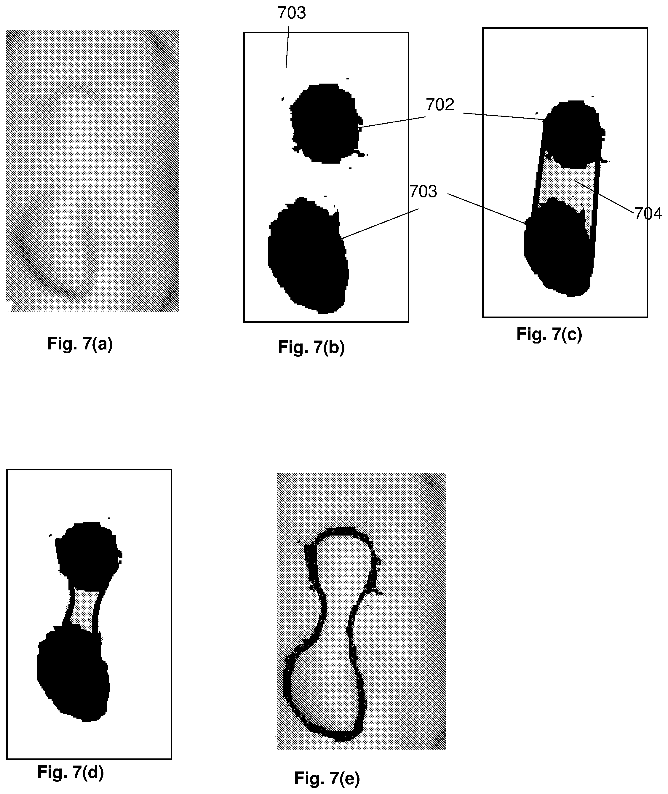 Patent US12165309 Figure 7 – Deformity edge detection
