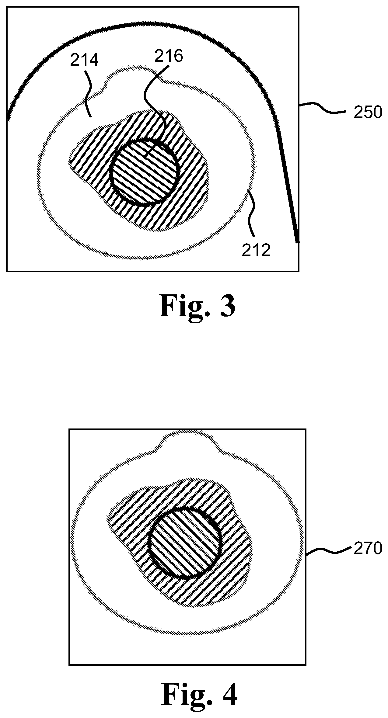 Patent US12165312 Figure 3 – Ostomy condition classification with masking, devices and related methods