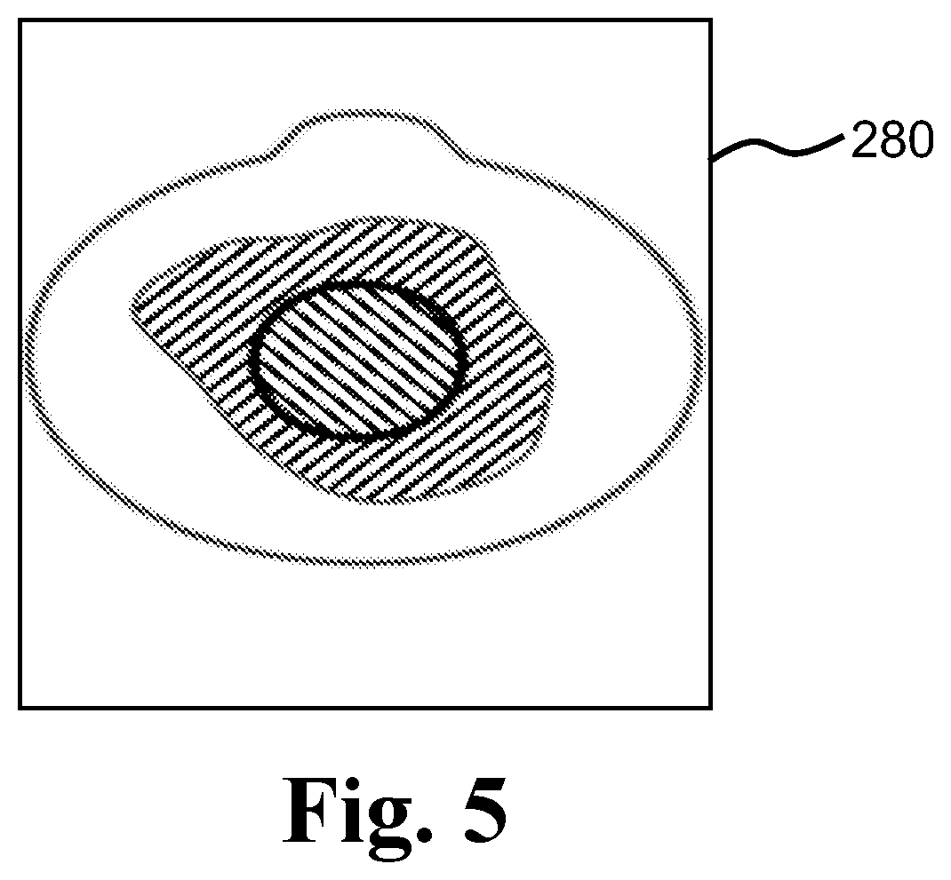 Patent US12165312 Figure 4 – Ostomy condition classification with masking, devices and related methods
