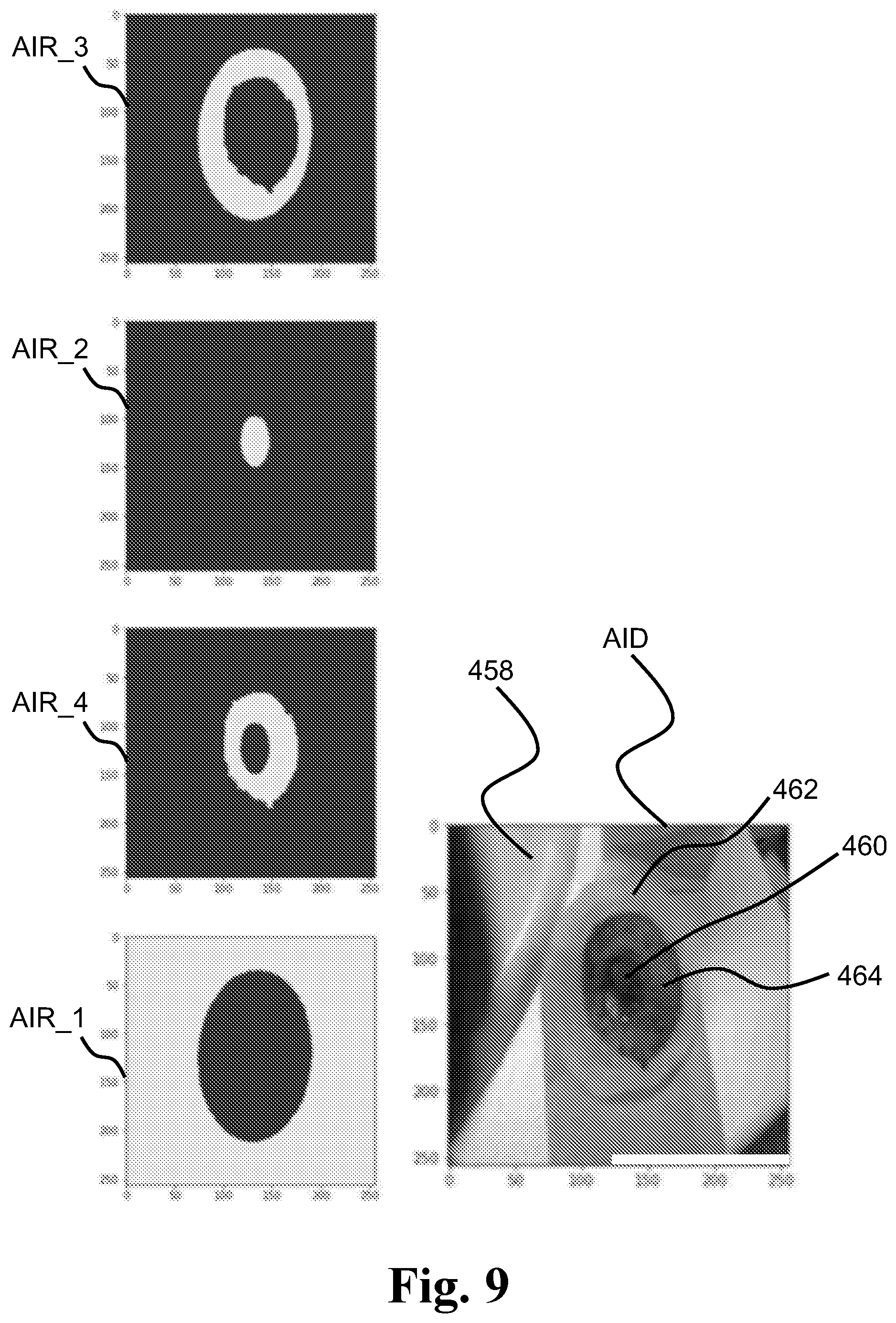 Patent US12165312 Figure 7 – Ostomy condition classification with masking, devices and related methods