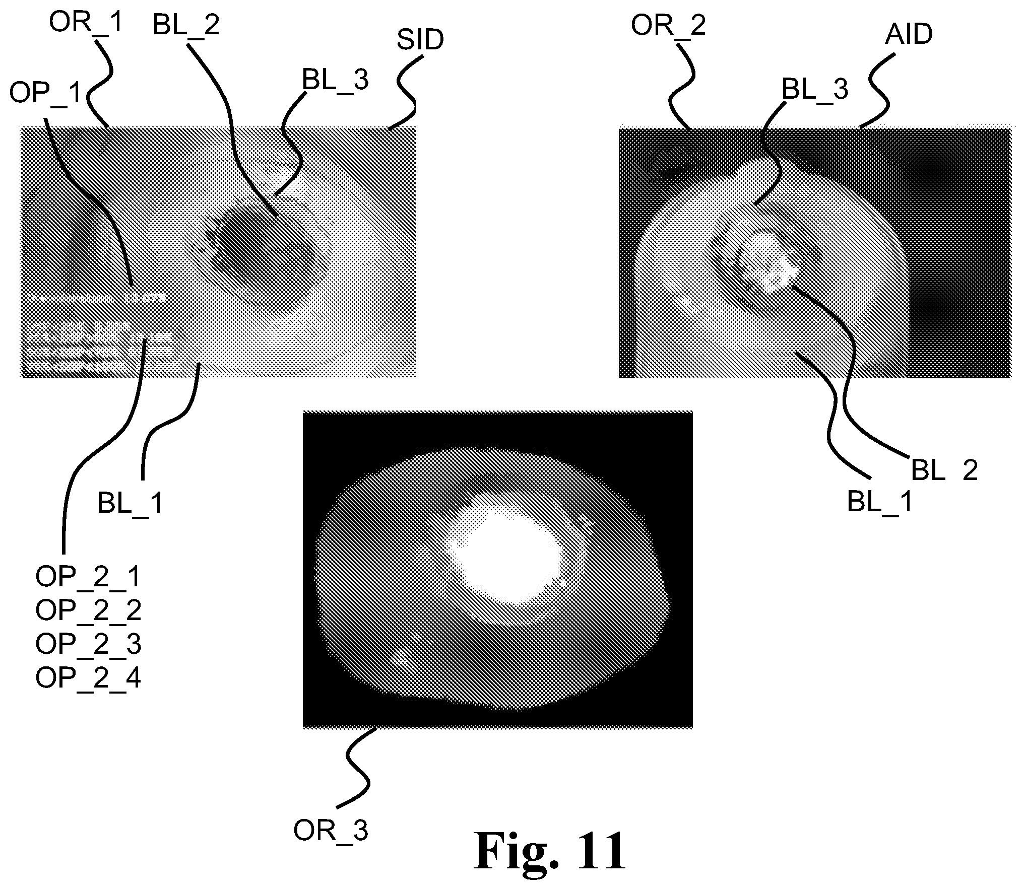 Patent US12165312 Figure 9 – Ostomy condition classification with masking, devices and related methods