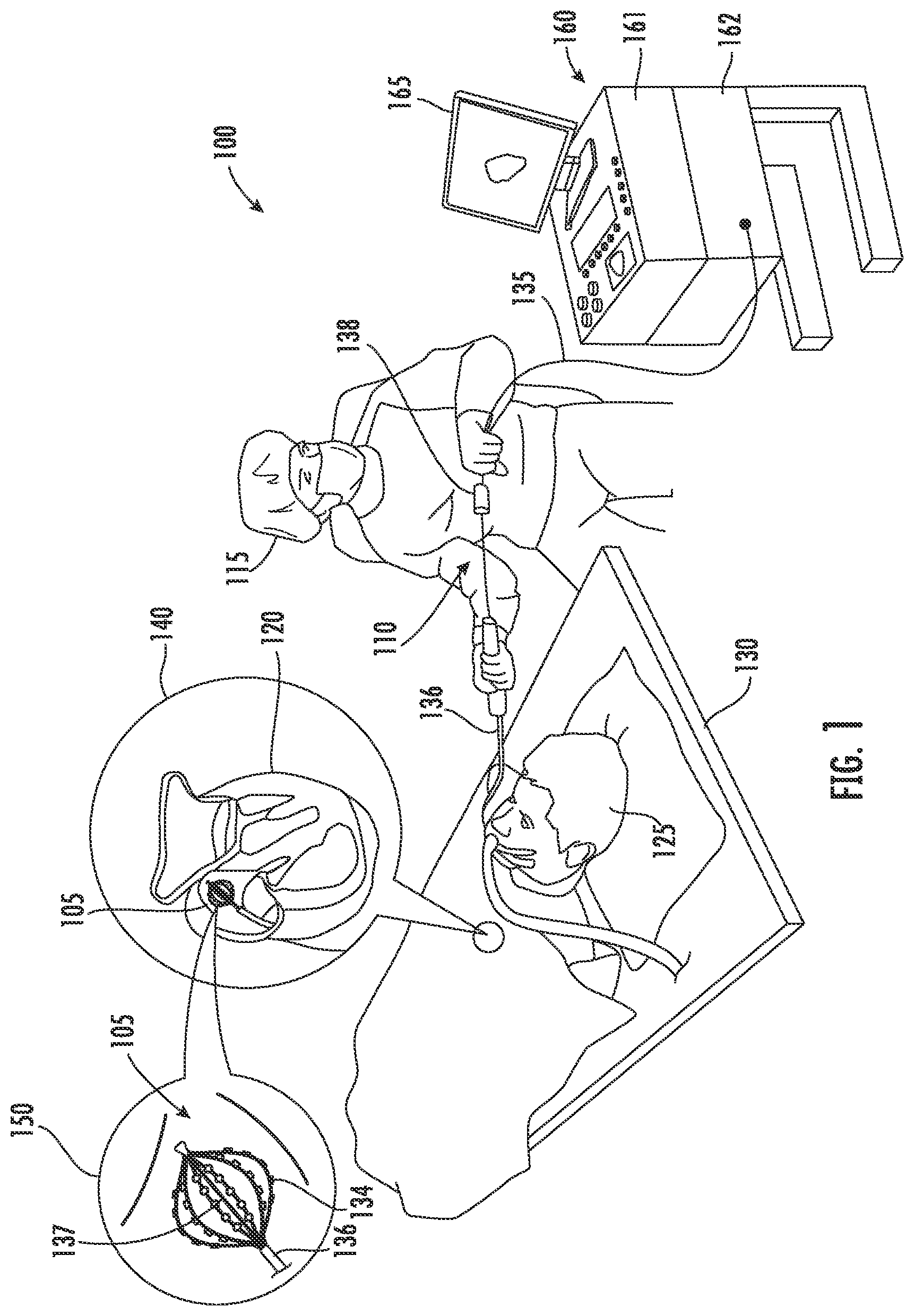 Patent US12165324 — Automatically identifying scar areas within organic tissue using multiple imaging modalities — Figure 1