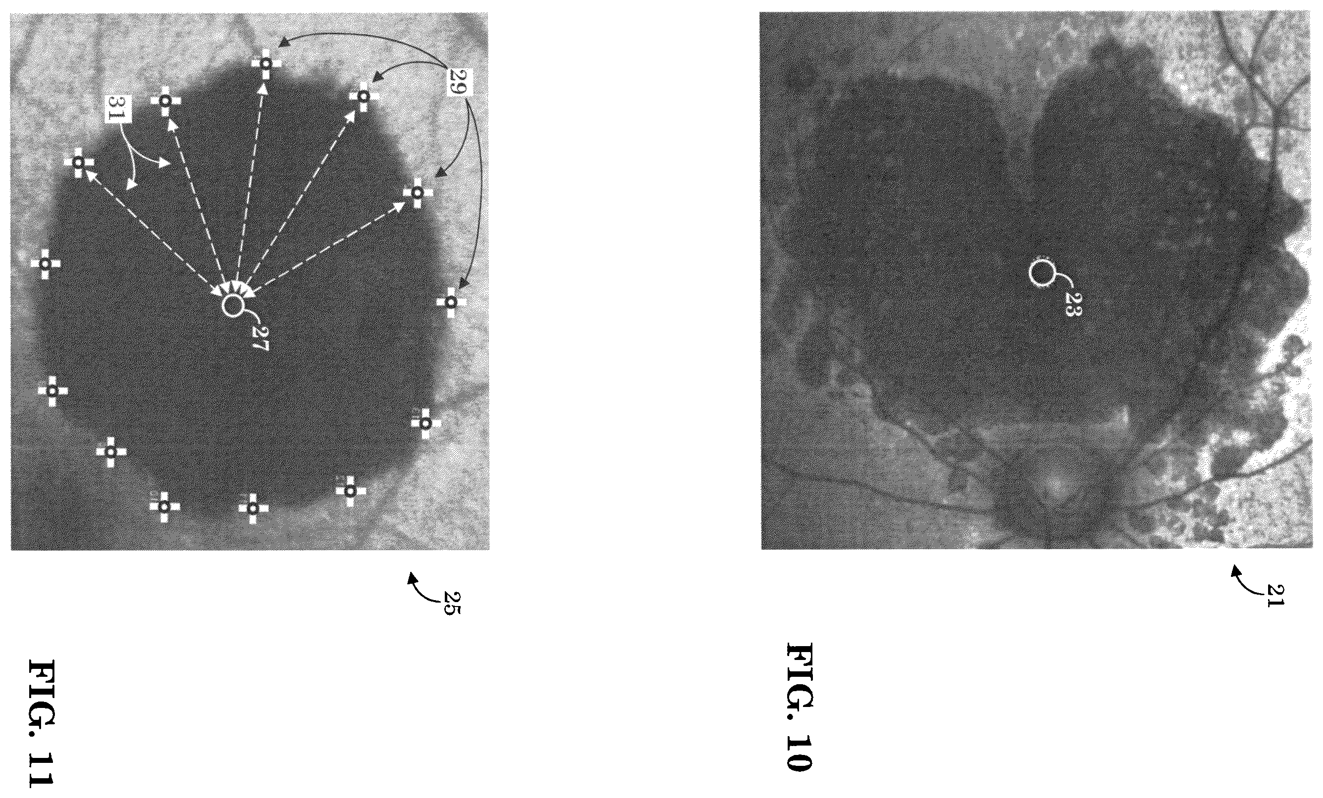 Patent US12165434 Figure 7 – Segmentation and classification of geographic atrophy patterns in patients with age related macular degeneration in widefield autofluorescence images