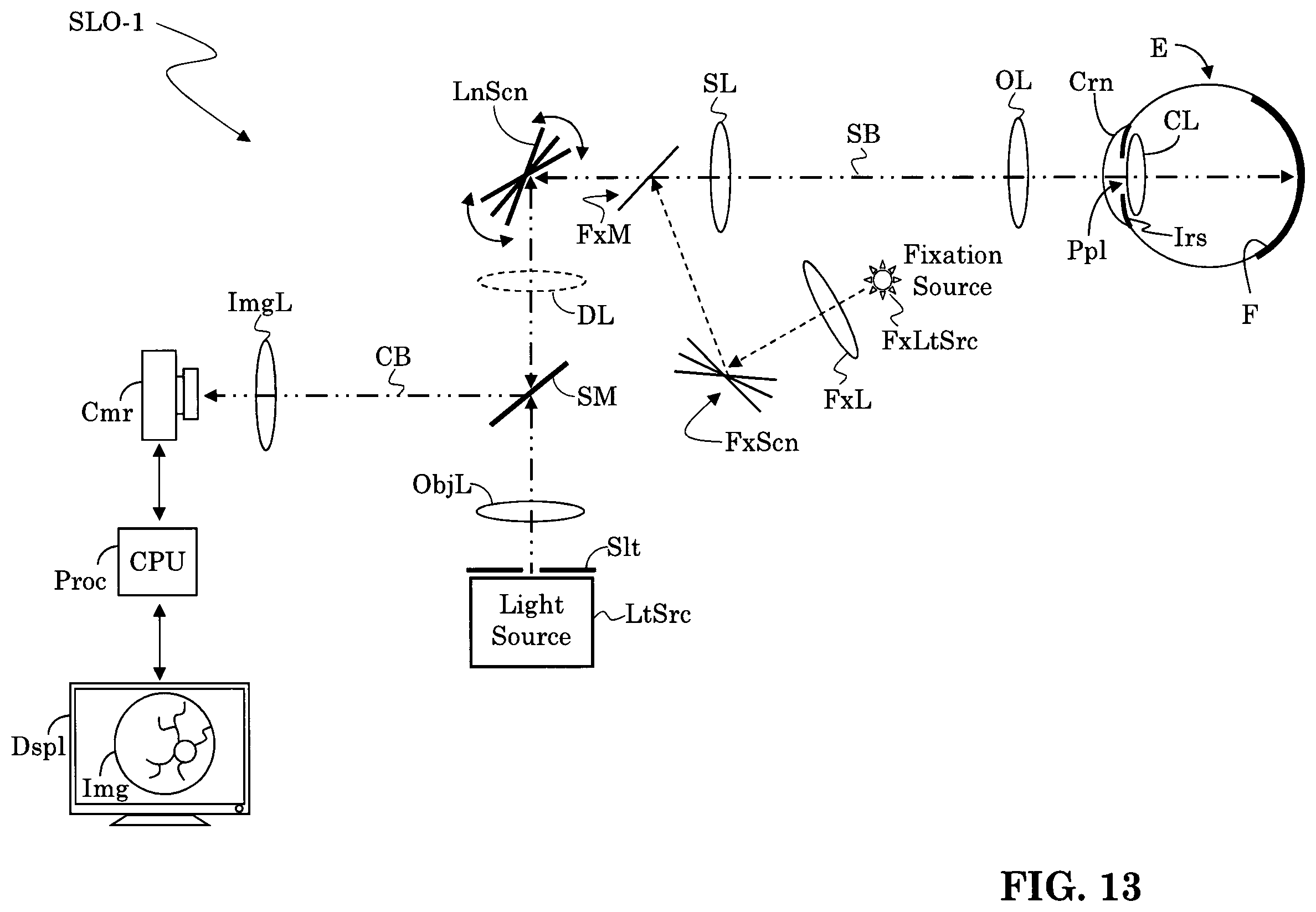 Patent US12165434 Figure 9 – Segmentation and classification of geographic atrophy patterns in patients with age related macular degeneration in widefield autofluorescence images