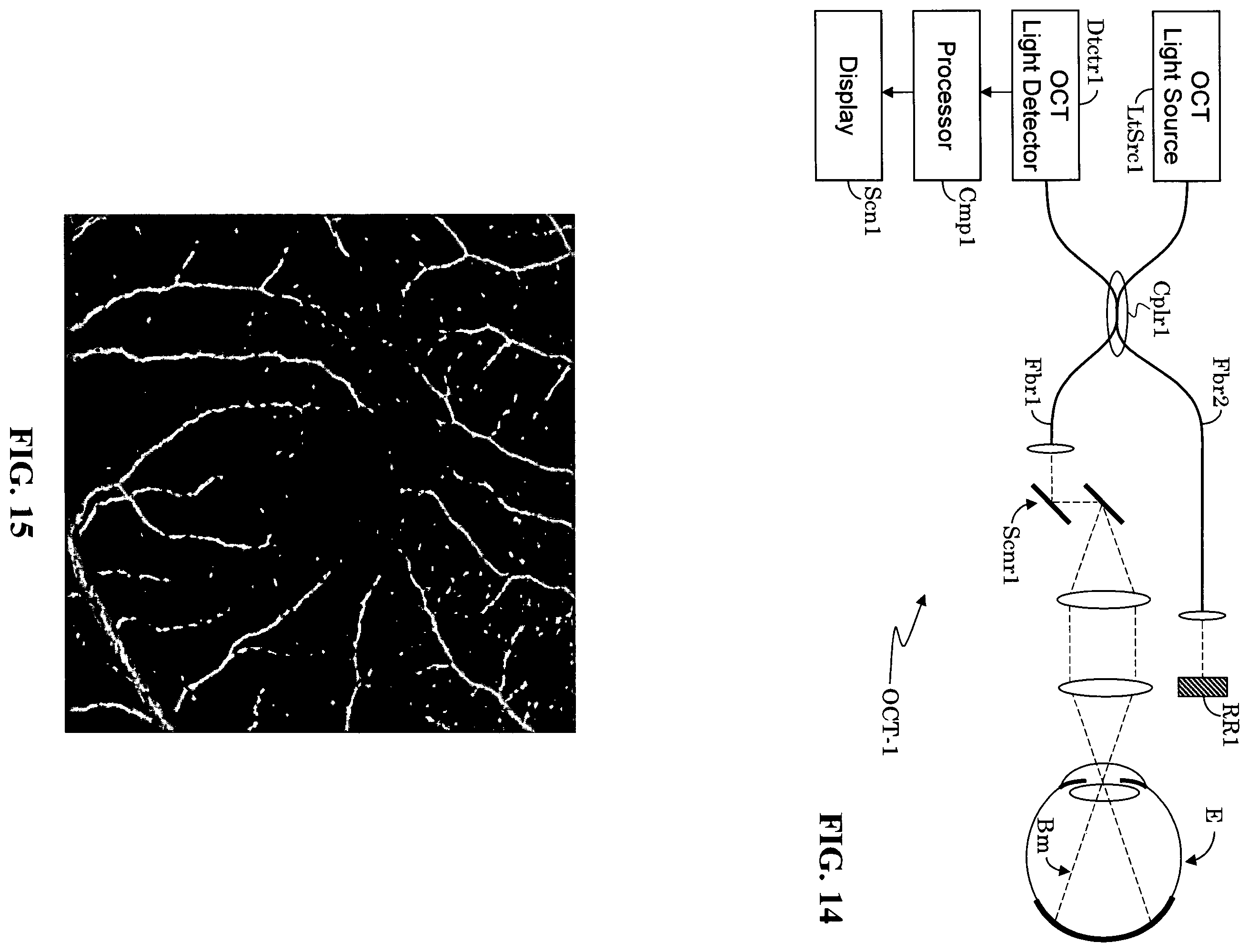 Patent US12165434 Figure 10 – Segmentation and classification of geographic atrophy patterns in patients with age related macular degeneration in widefield autofluorescence images