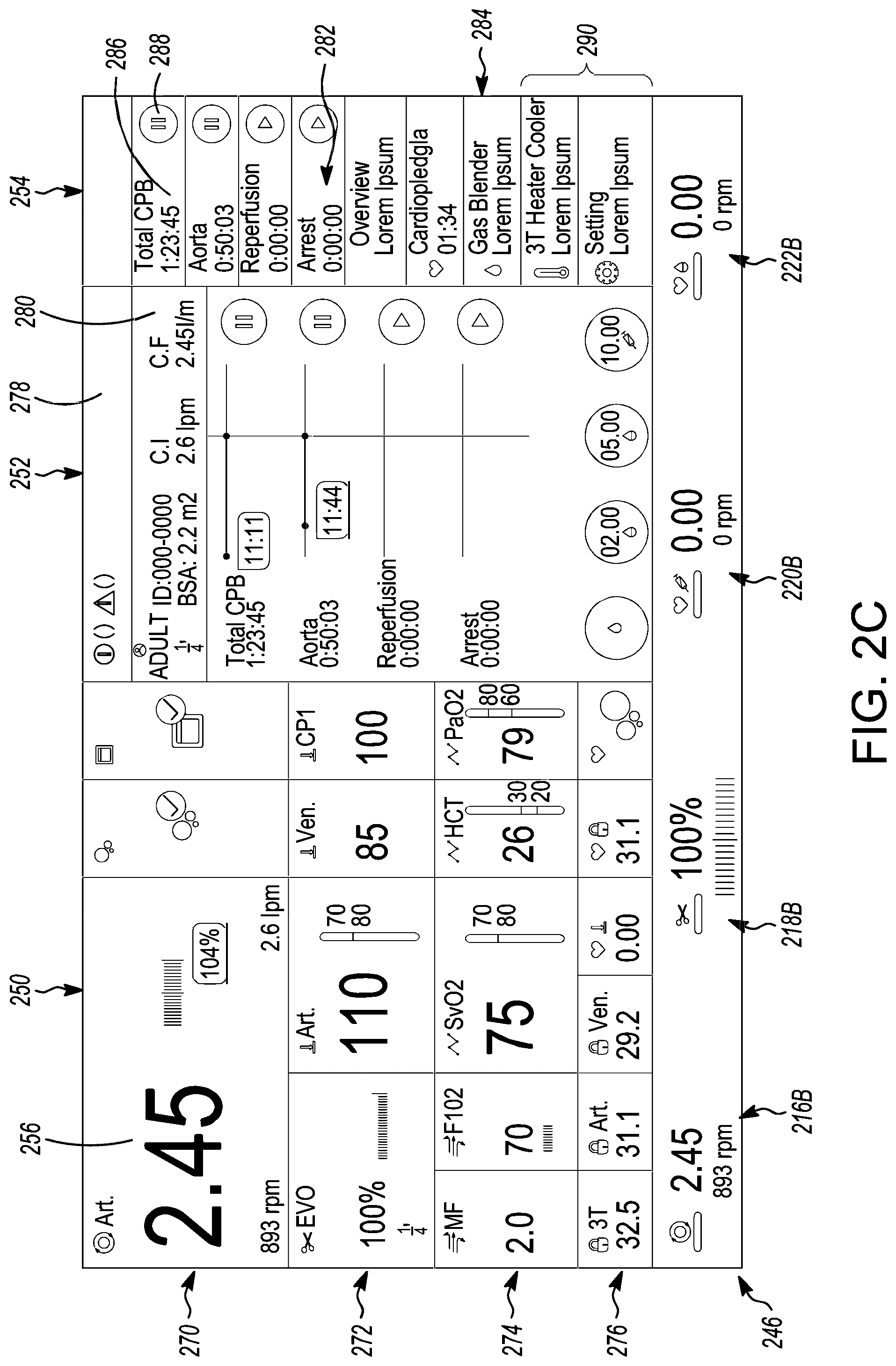 Patent US12165617 Figure 5 – Heart lung machine having control assembly with space-saving display features