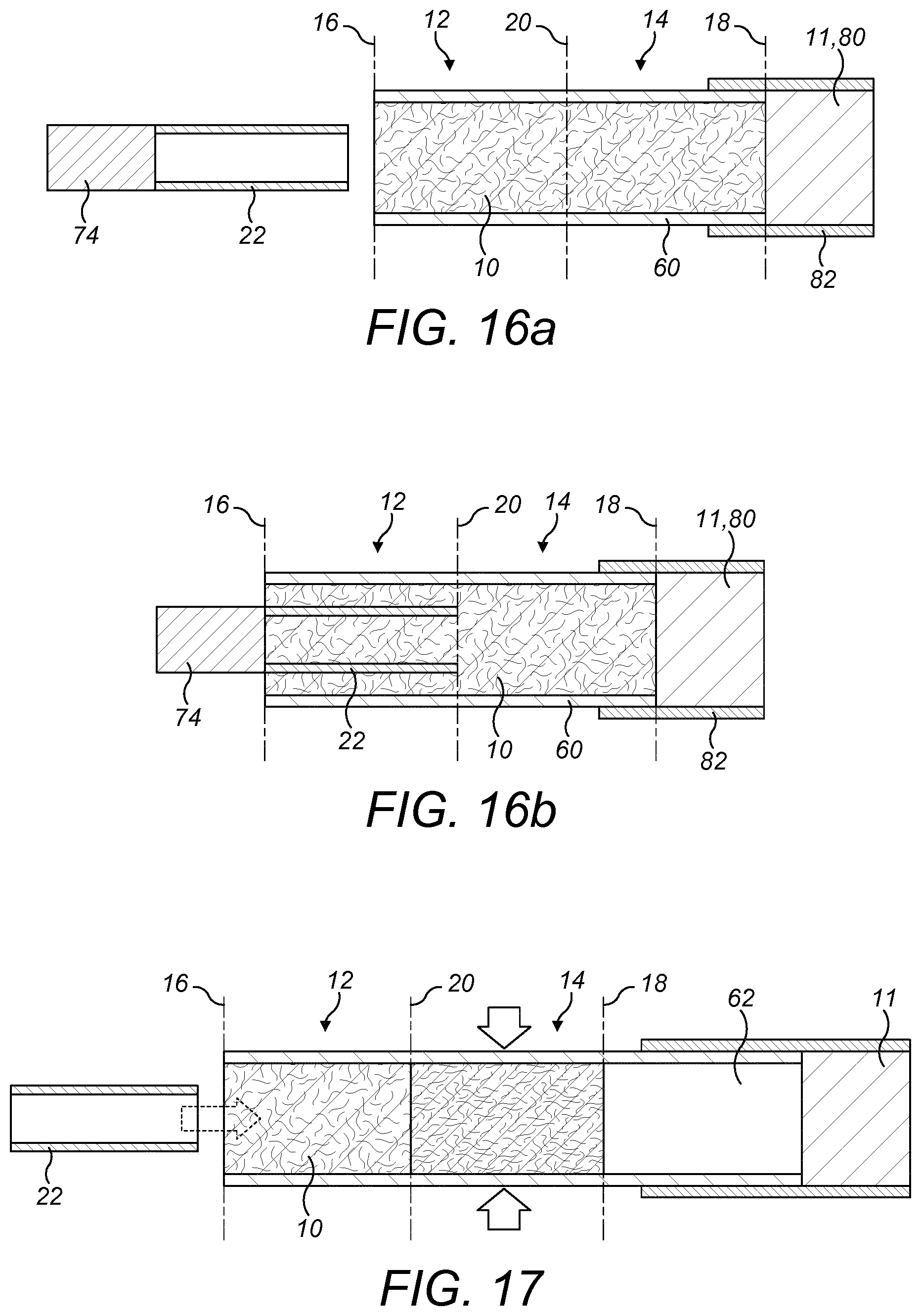 Patent US12167753 Figure 11 – Aerosol generating article, a method for manufacturing an aerosol generating article and an aerosol generating system