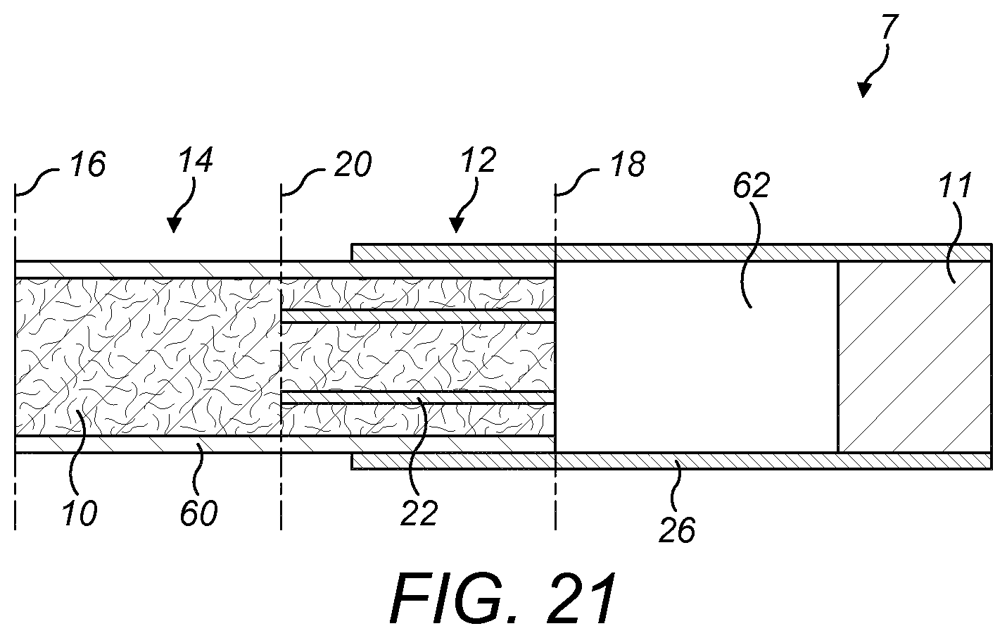 Patent US12167753 Figure 14 – Aerosol generating article, a method for manufacturing an aerosol generating article and an aerosol generating system