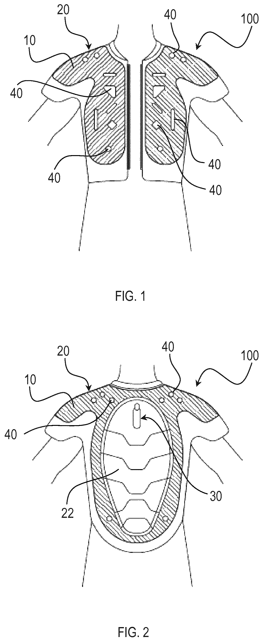Patent US12167758 Figure 1 – Wearable airbag device