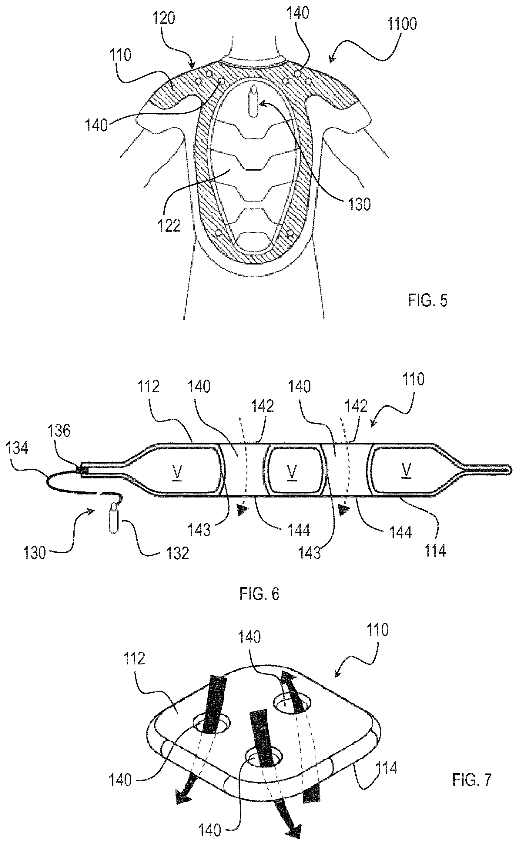 Patent US12167758 Figure 3 – Wearable airbag device