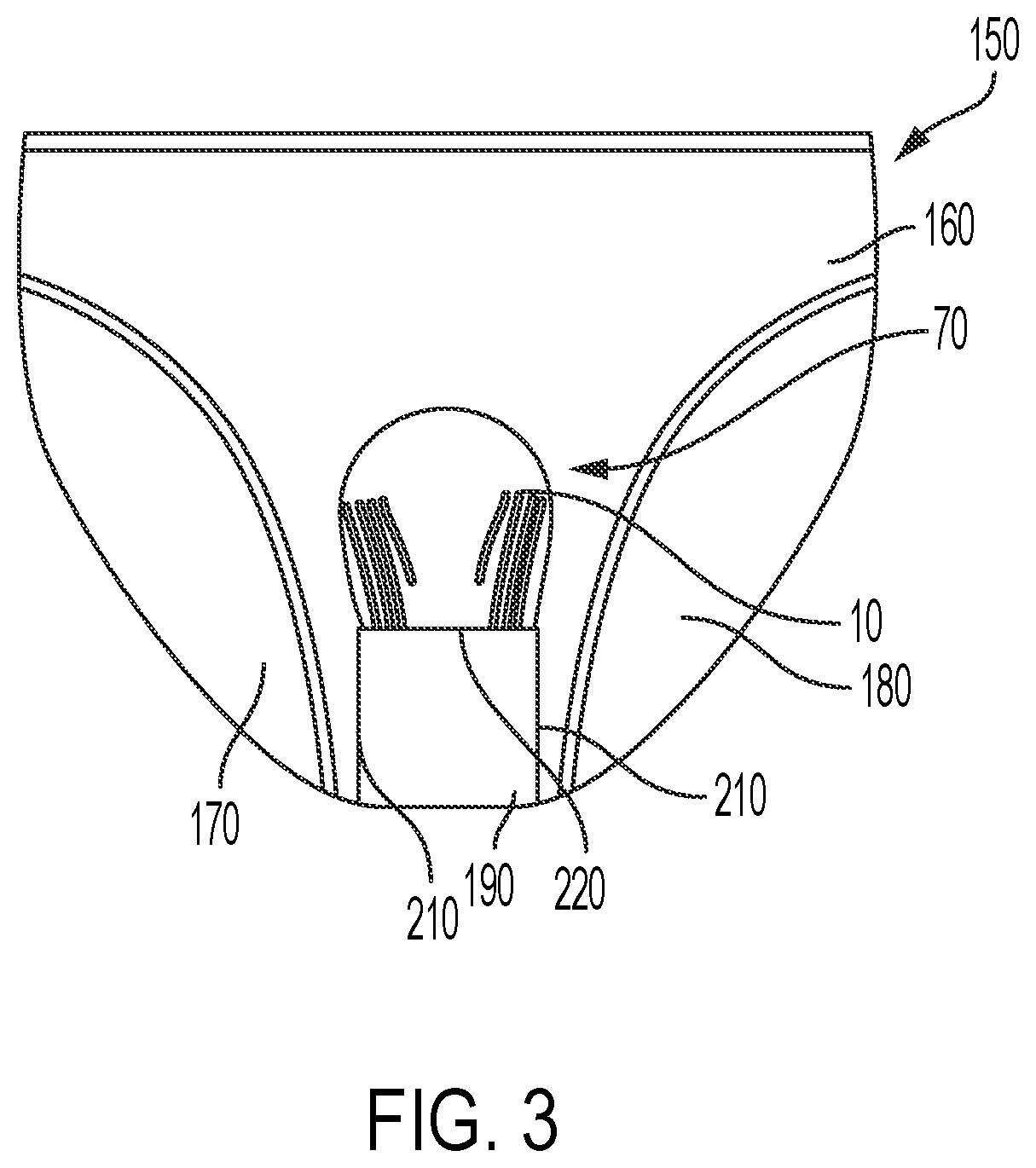 Patent US12167760 Figure 3 – Body contour concealer device