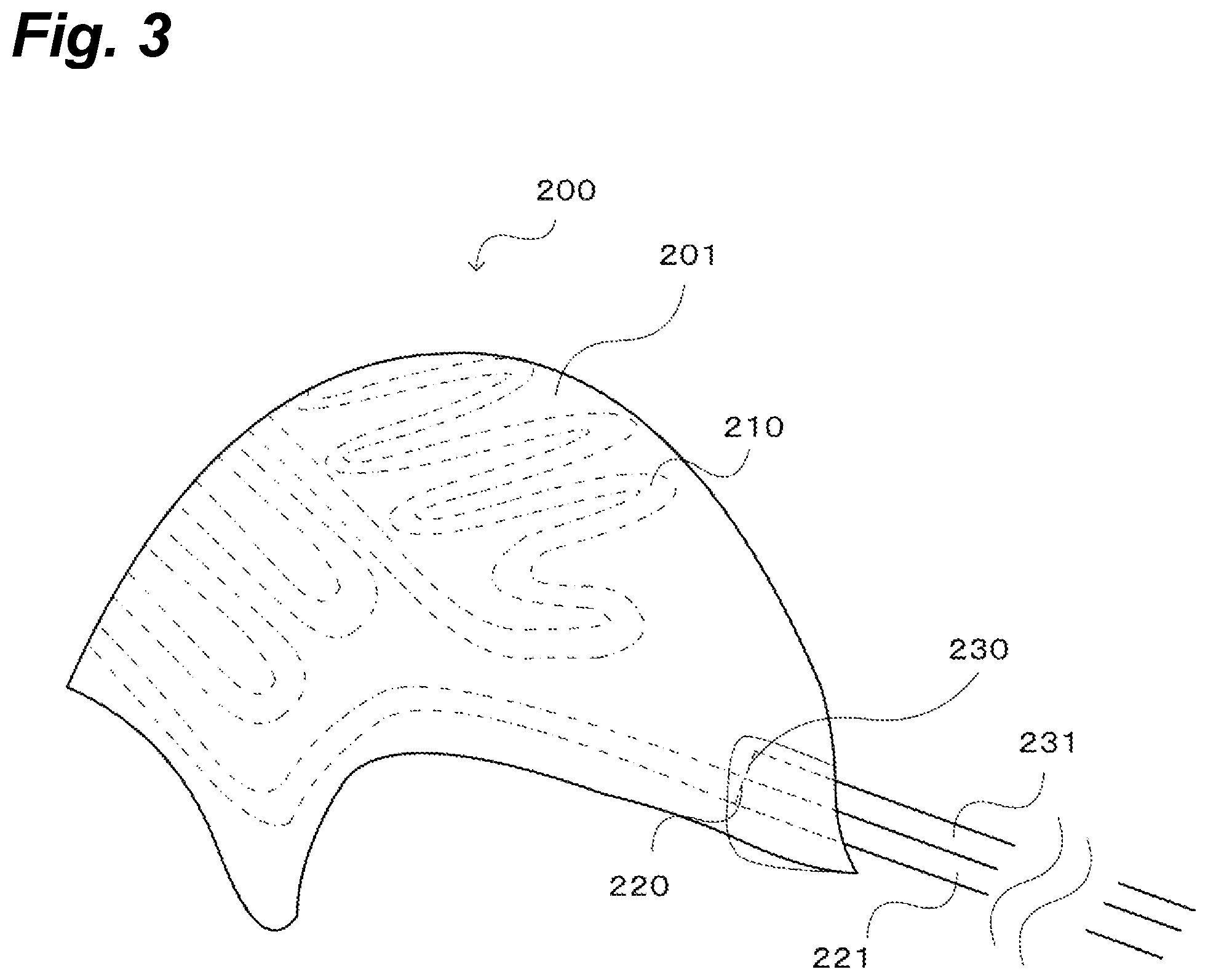Patent US12167763 Figure 3 – Medical head-cooling cap set