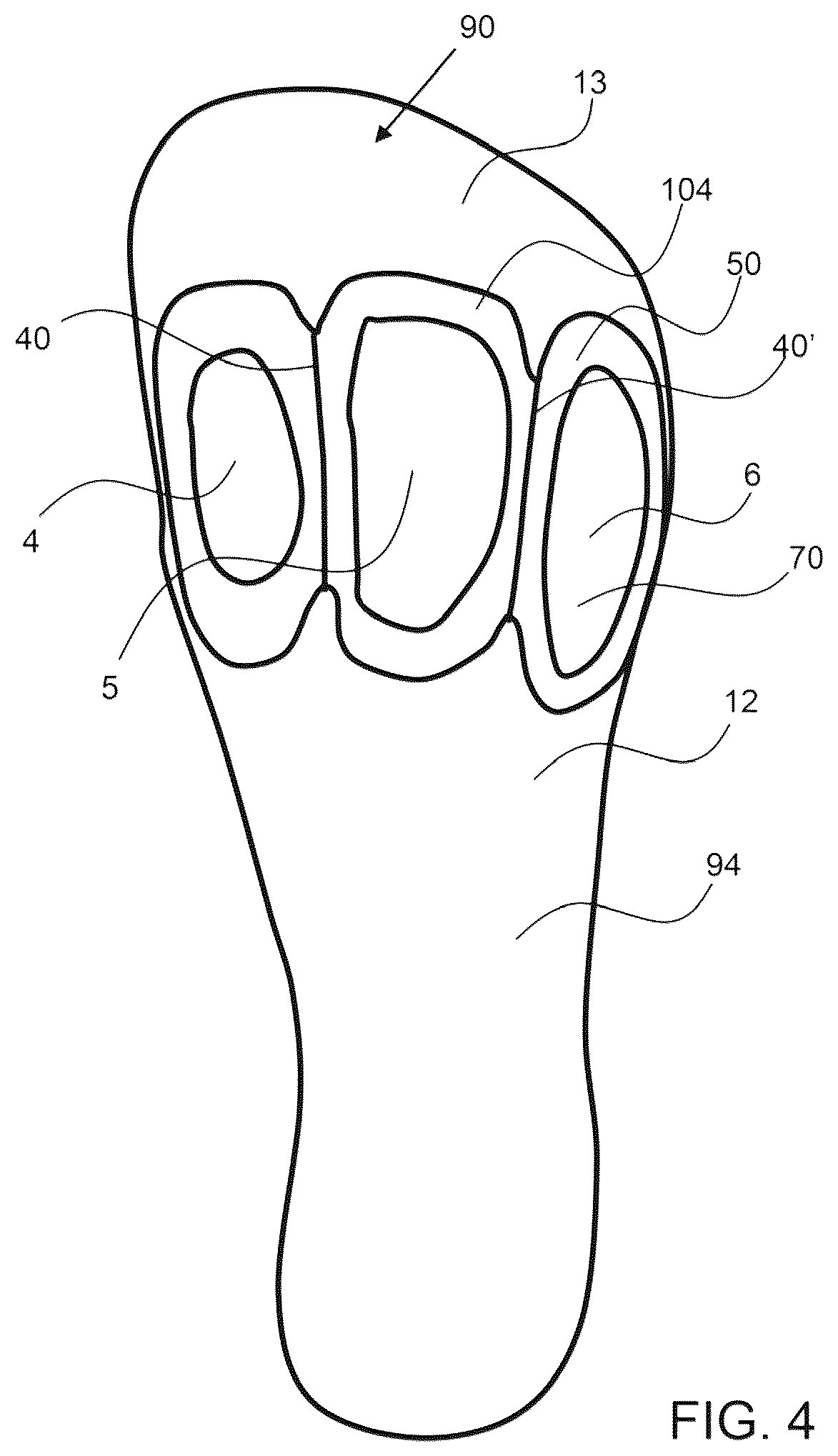 Patent US12167775 Figure 4 – Flexible forefoot protection for insoles and shoes