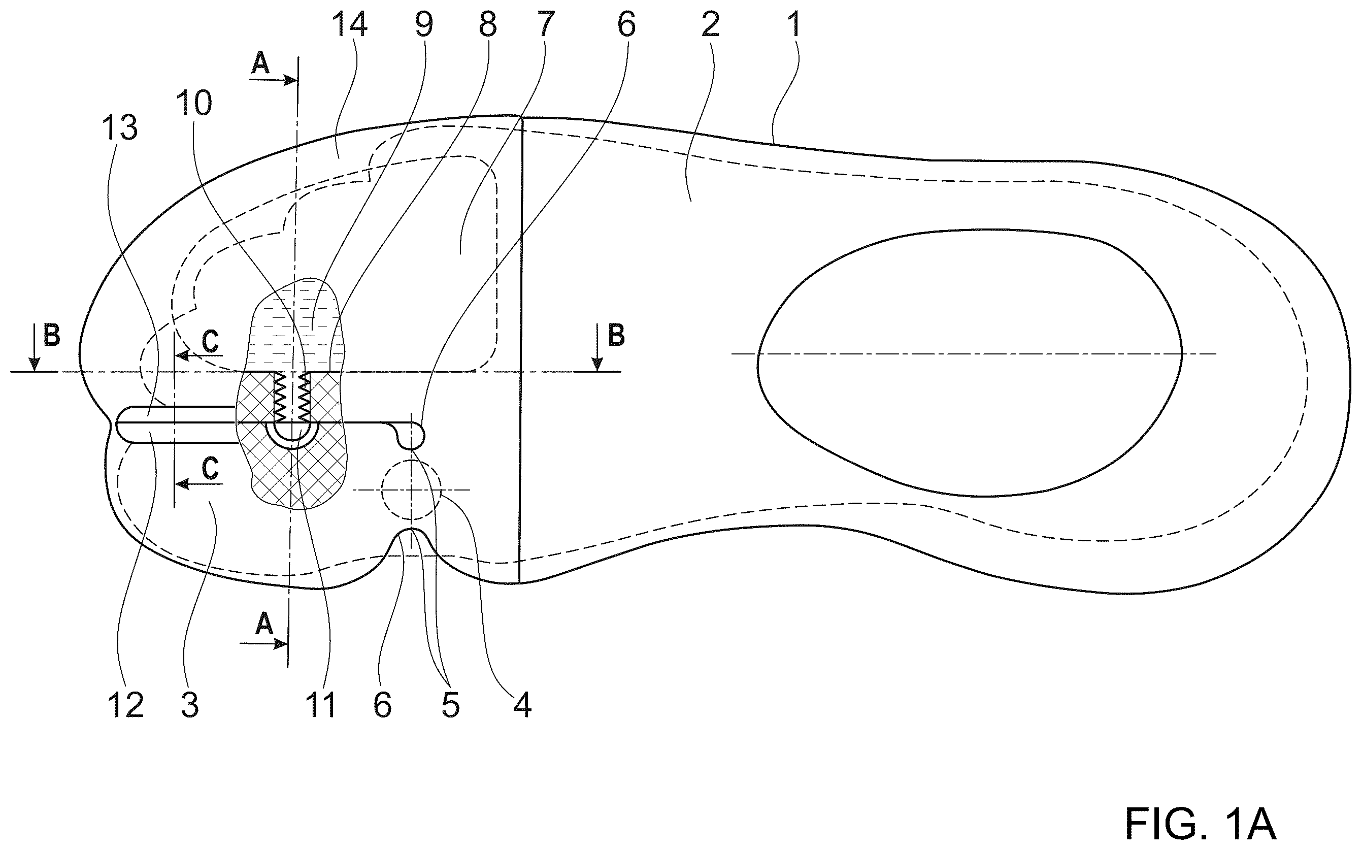 Patent US12167776 Figure 1 – Orthopedic shoe sole or insole and shoe for people with hallux valgus