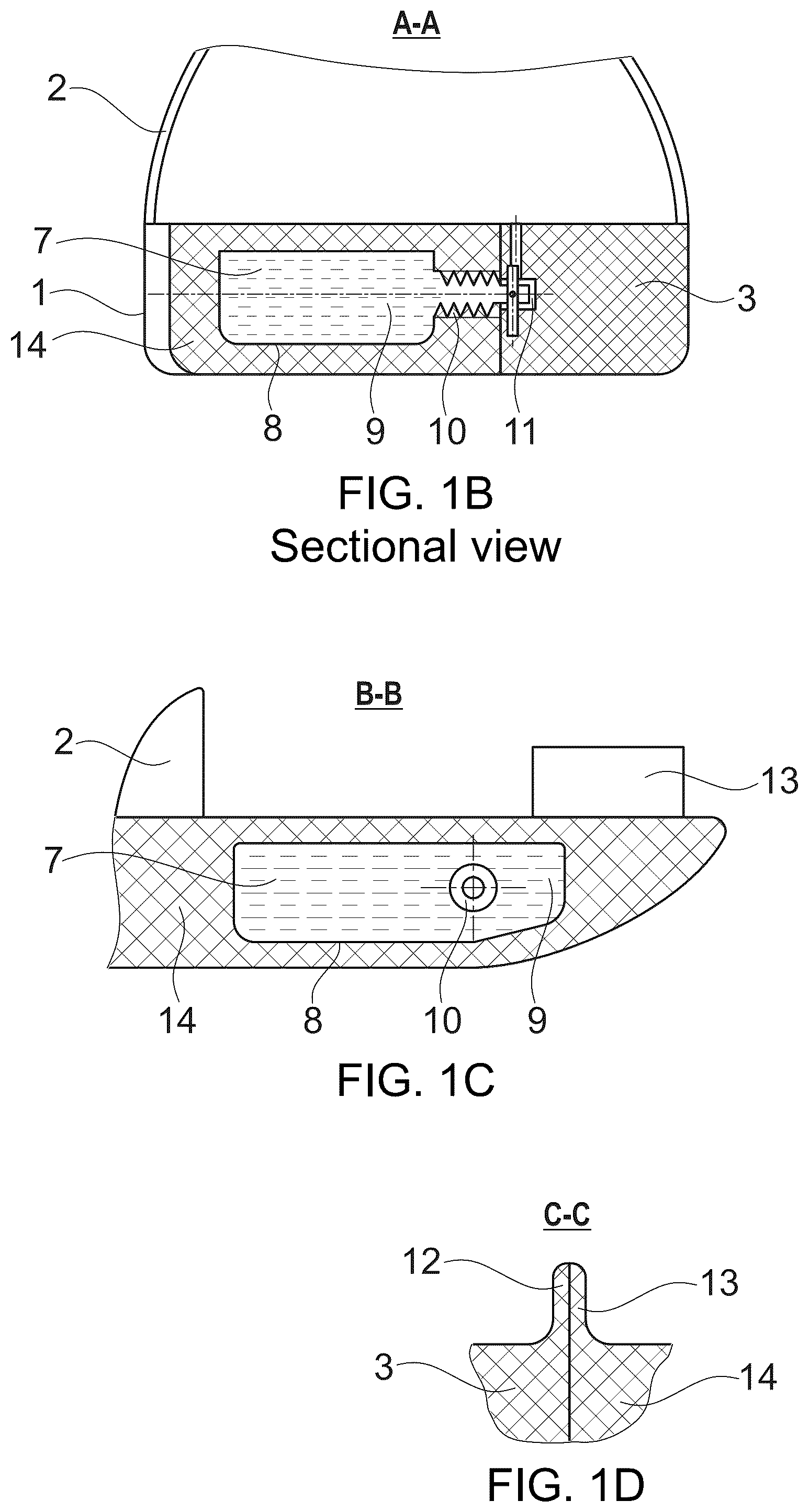 Patent US12167776 Figure 2 – Orthopedic shoe sole or insole and shoe for people with hallux valgus
