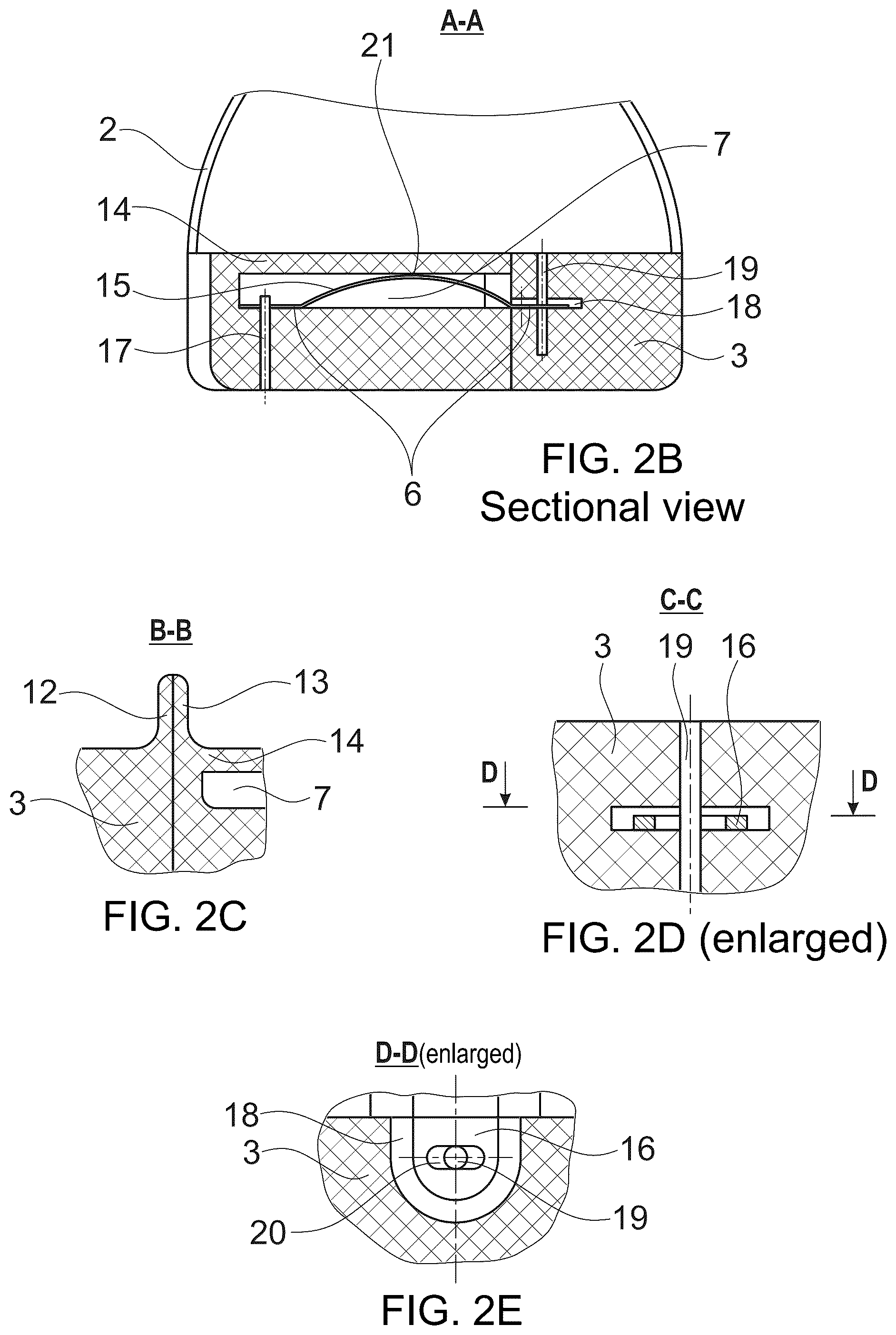Patent US12167776 Figure 4 – Orthopedic shoe sole or insole and shoe for people with hallux valgus