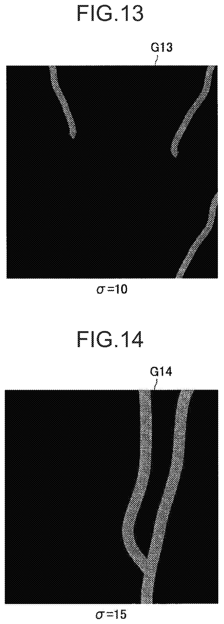 Patent US12167828 Figure 10 – Image processing apparatus, image processing method, and image processing system for improving visibility of indocyanine green image