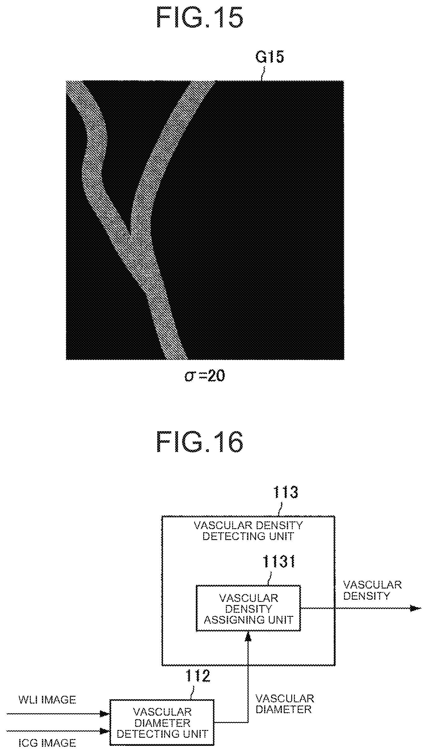 Patent US12167828 Figure 11 – Image processing apparatus, image processing method, and image processing system for improving visibility of indocyanine green image