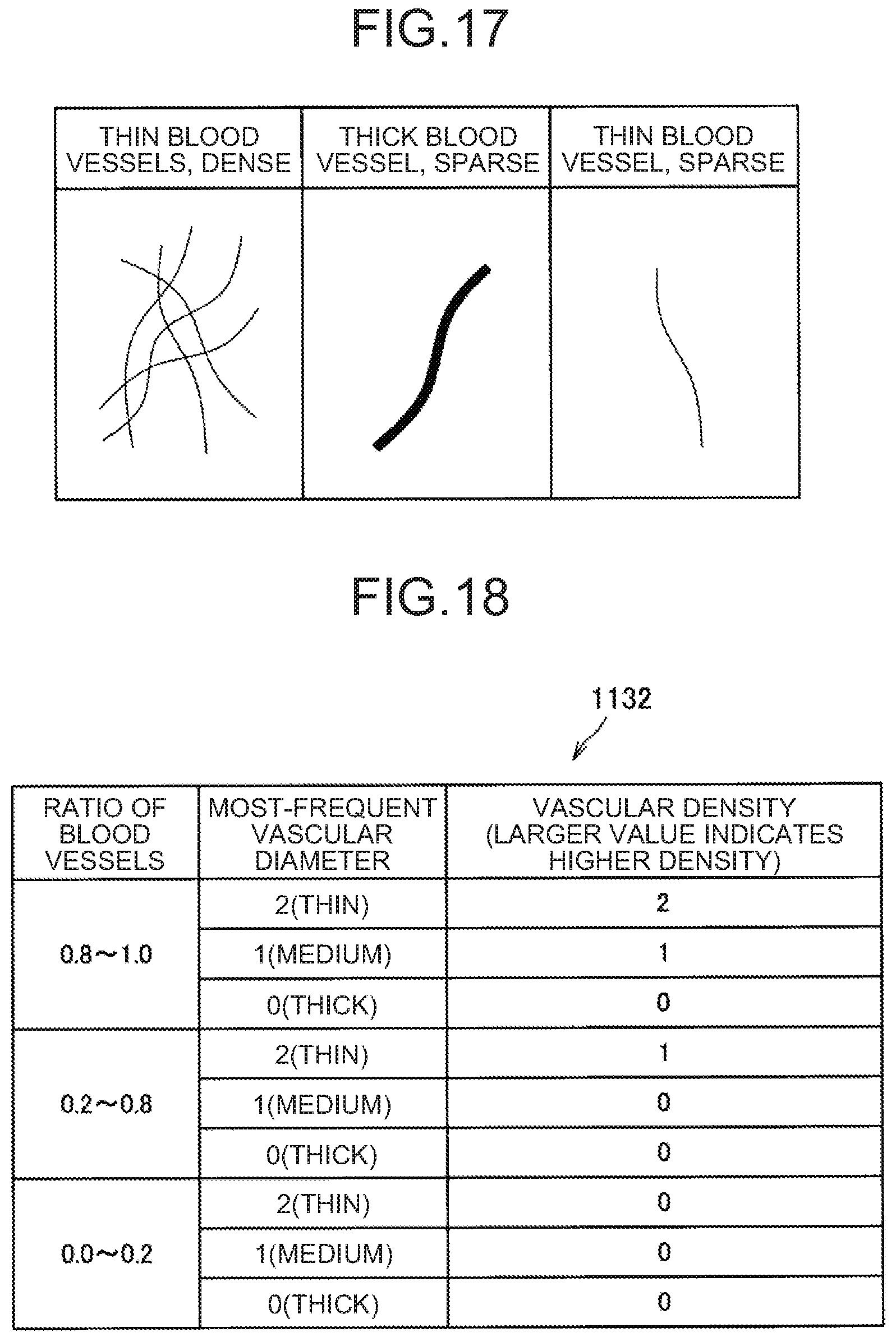 Patent US12167828 Figure 12 – Image processing apparatus, image processing method, and image processing system for improving visibility of indocyanine green image