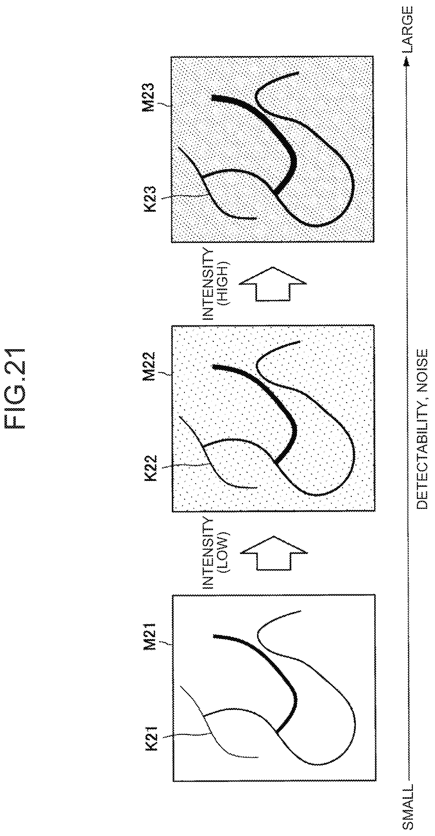 Patent US12167828 Figure 14 – Image processing apparatus, image processing method, and image processing system for improving visibility of indocyanine green image