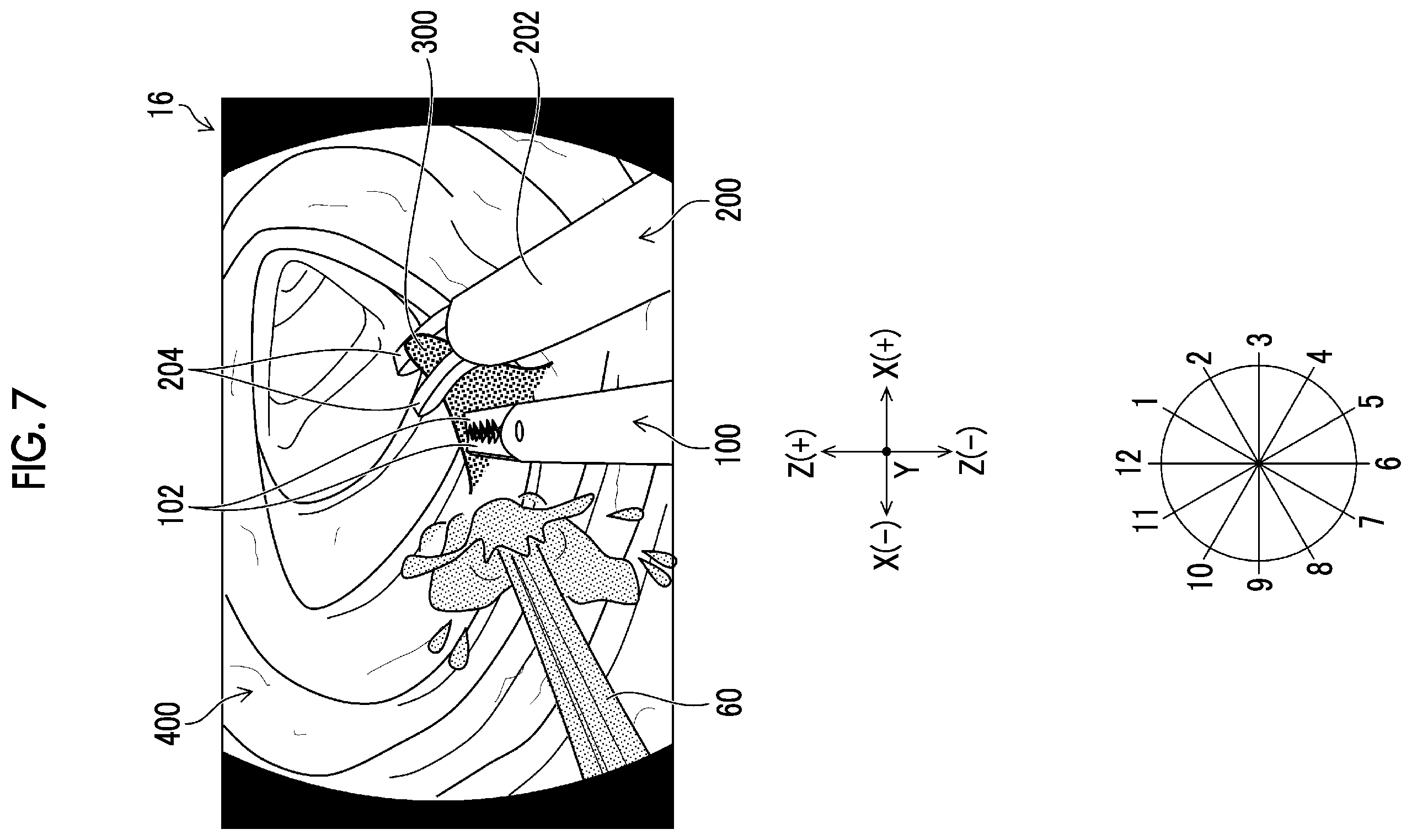 Patent US12167832 Figure 6 – Endoscope having a treatment tool outlet port