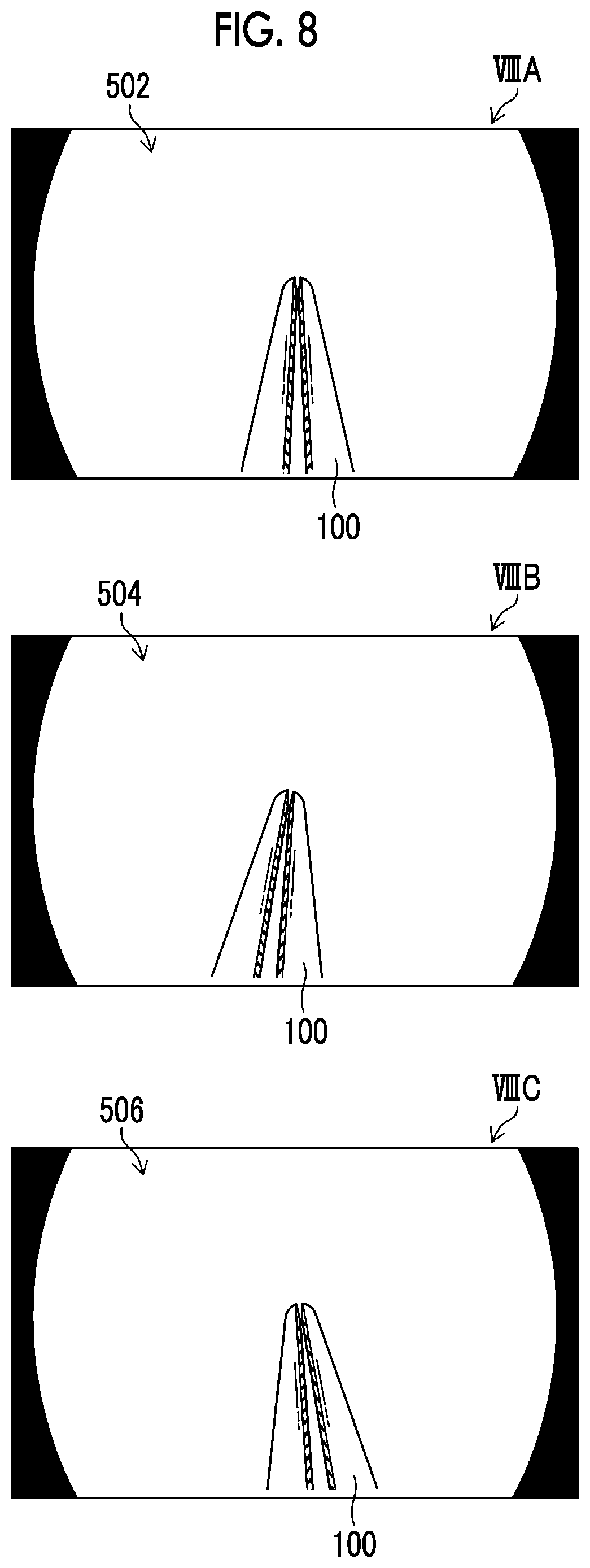 Patent US12167832 Figure 7 – Endoscope having a treatment tool outlet port