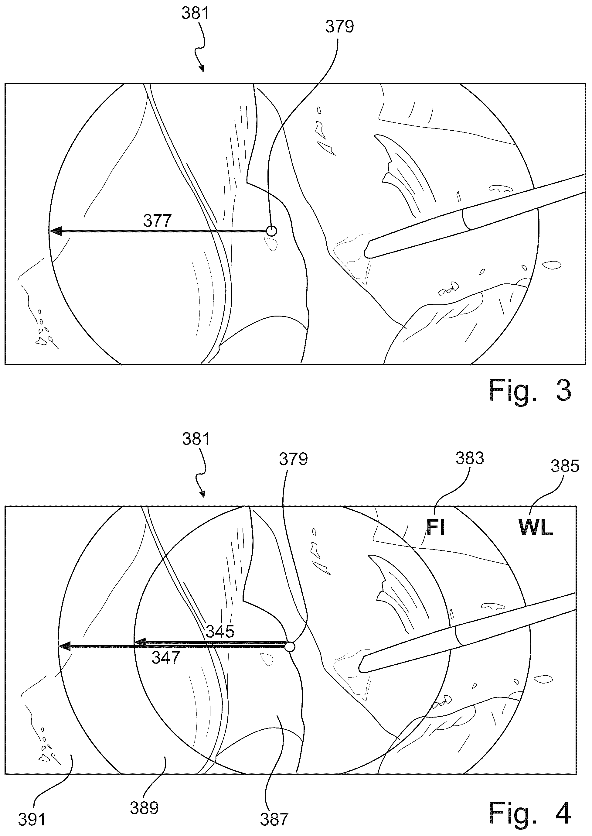 Patent US12167836 Figure 2 – Optical filter system for a video endoscope, display system and video endoscope