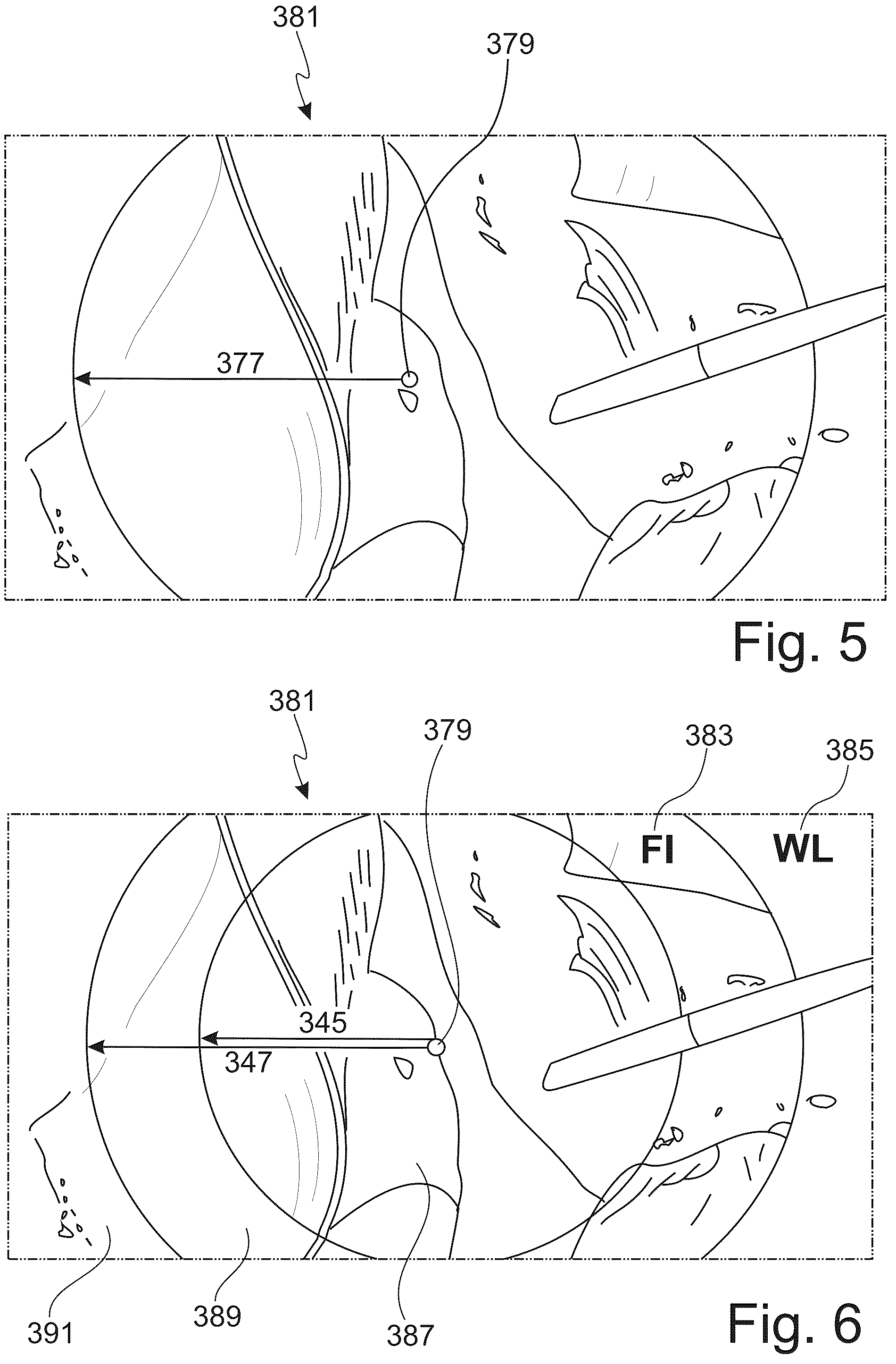 Patent US12167836 Figure 3 – Optical filter system for a video endoscope, display system and video endoscope