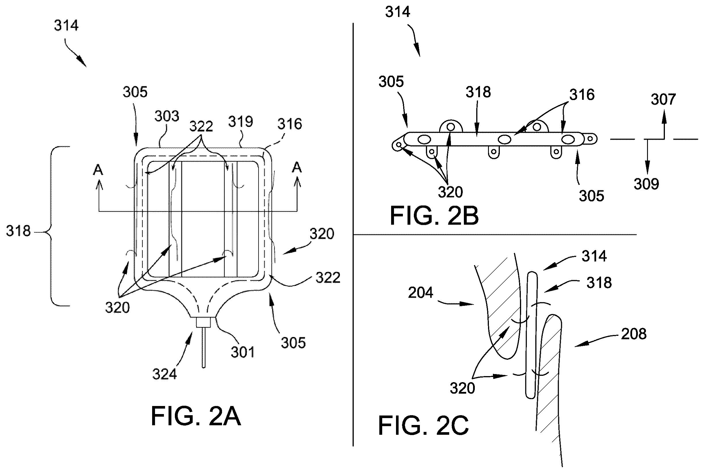 Patent US12167843 Figure 2 – Patent foramen ovale (PFO) tunnel filler