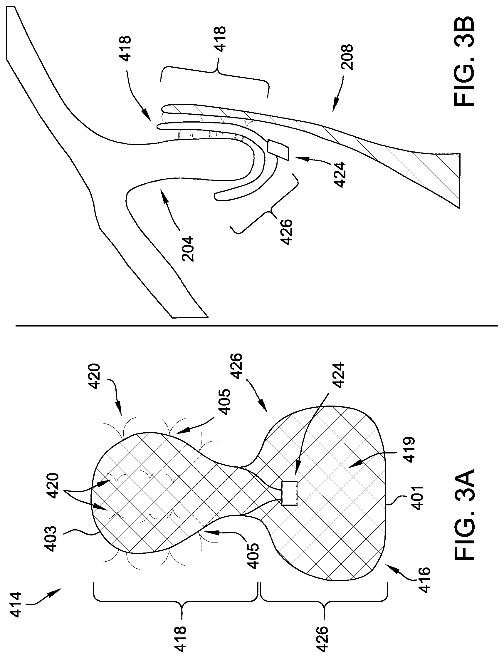 Patent US12167843 Figure 4 – Patent foramen ovale (PFO) tunnel filler
