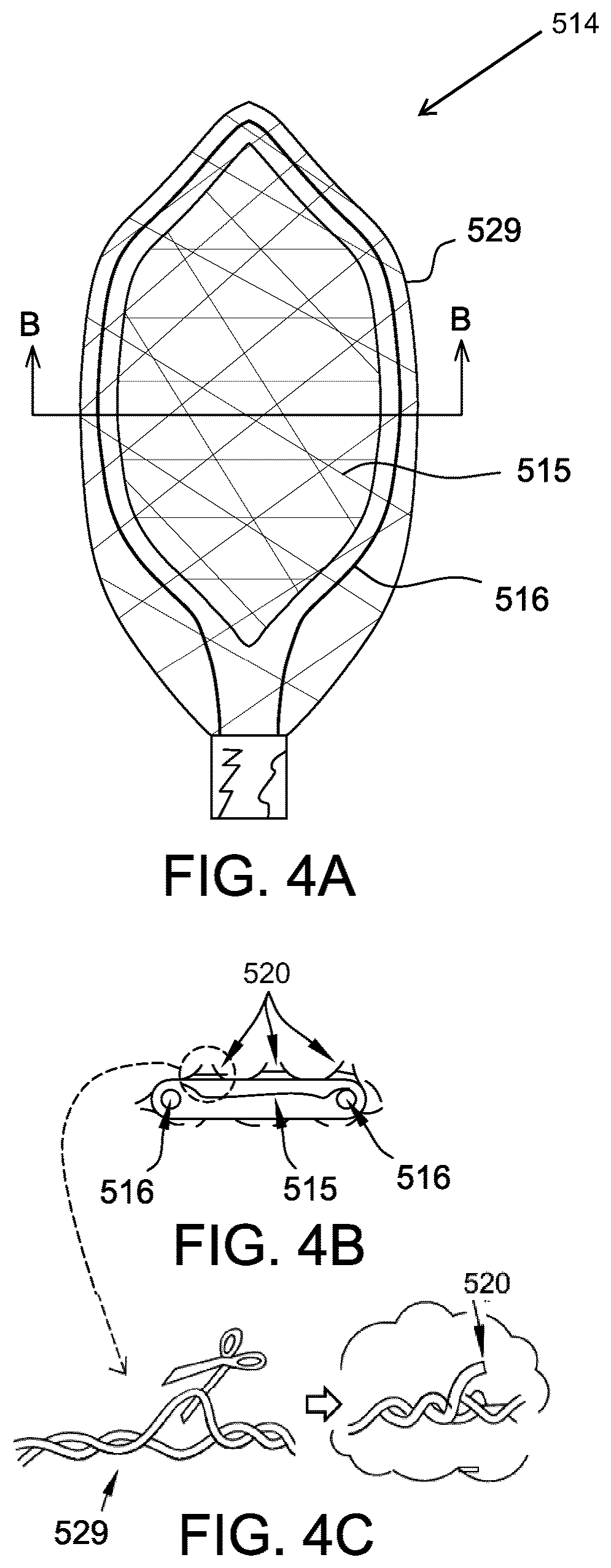 Patent US12167843 Figure 5 – Patent foramen ovale (PFO) tunnel filler