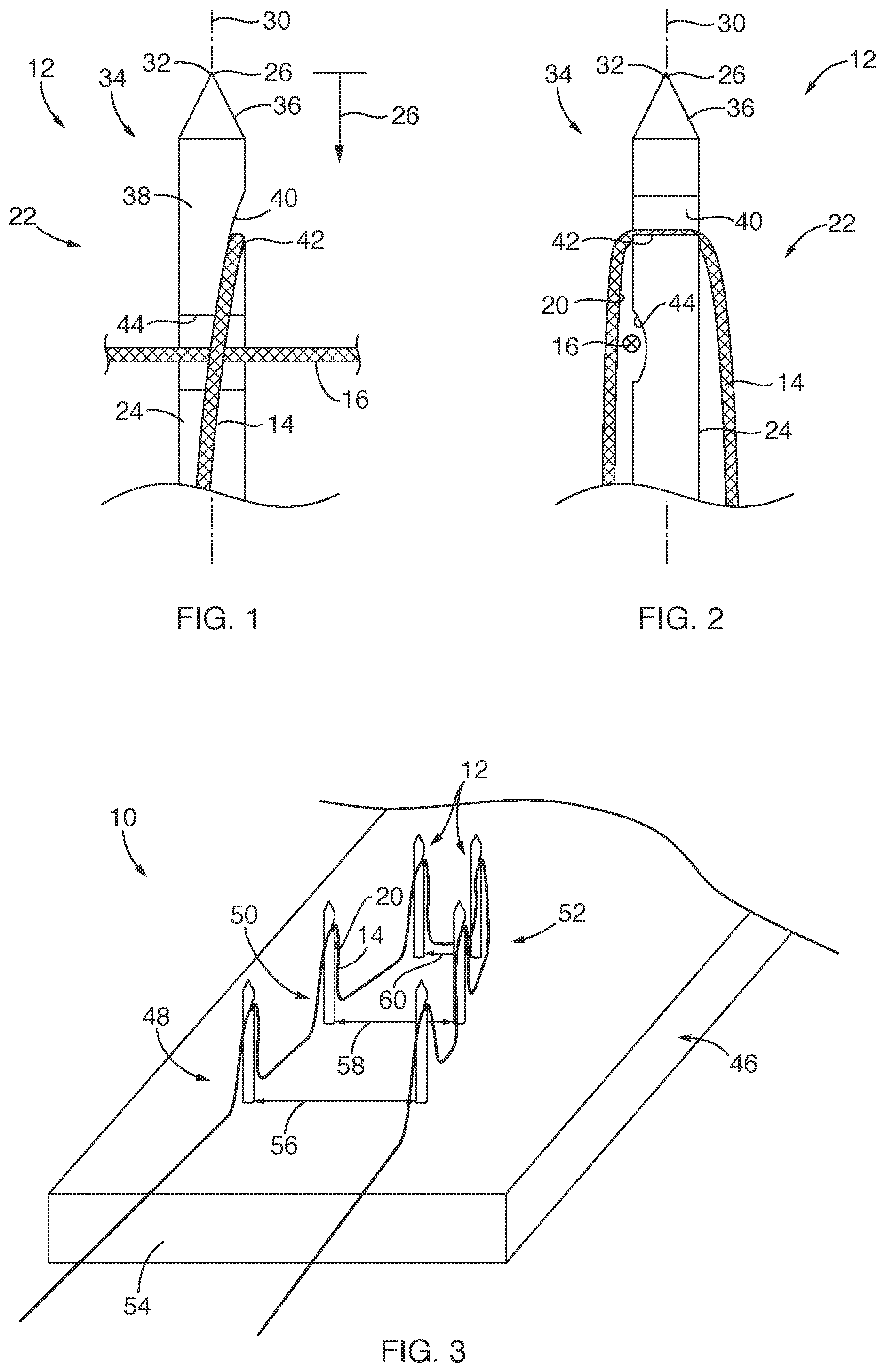 Patent US12167847 Figure 1 – Devices, systems, and methods for coupling flexible filament to soft tissue