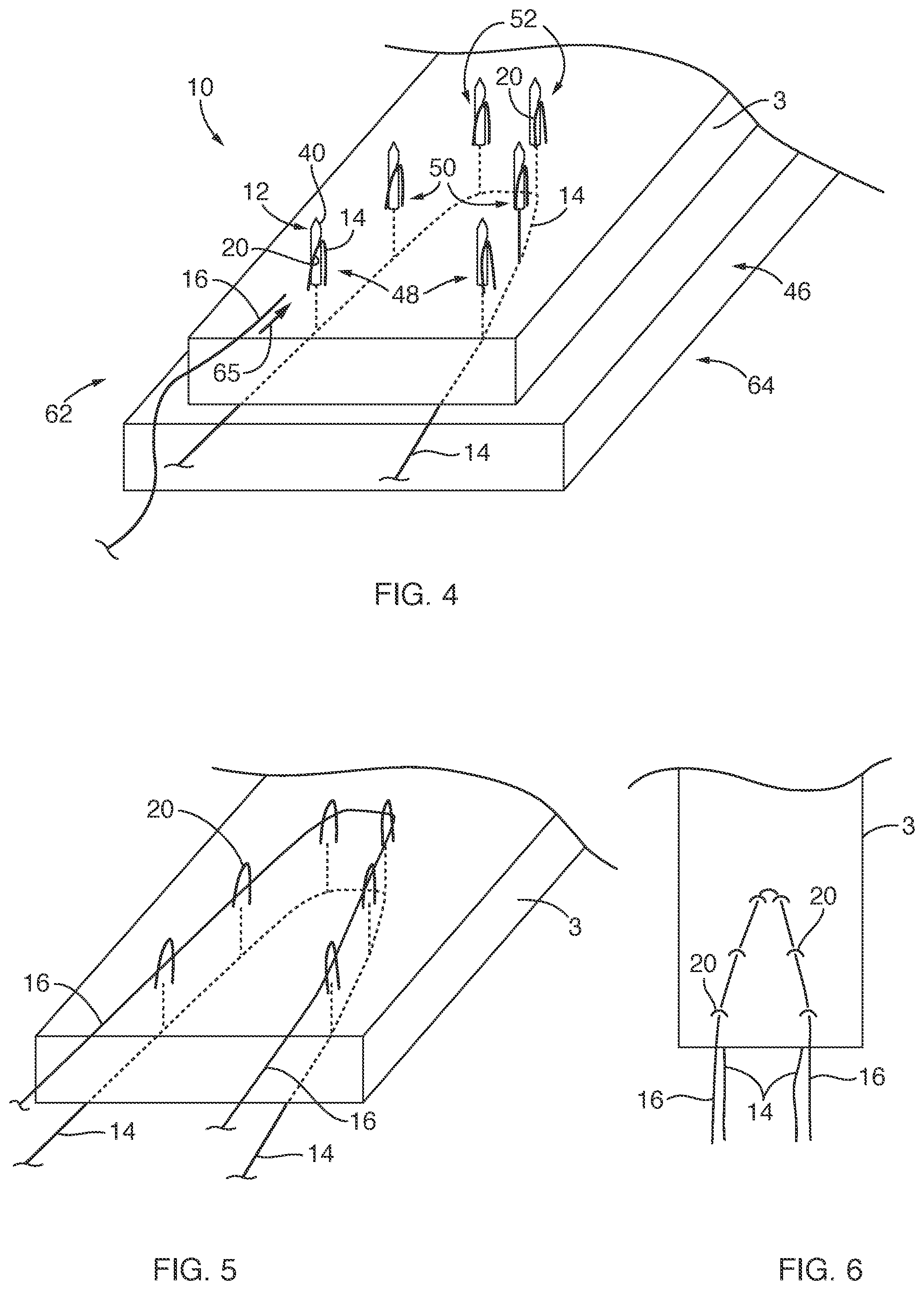 Patent US12167847 Figure 2 – Devices, systems, and methods for coupling flexible filament to soft tissue
