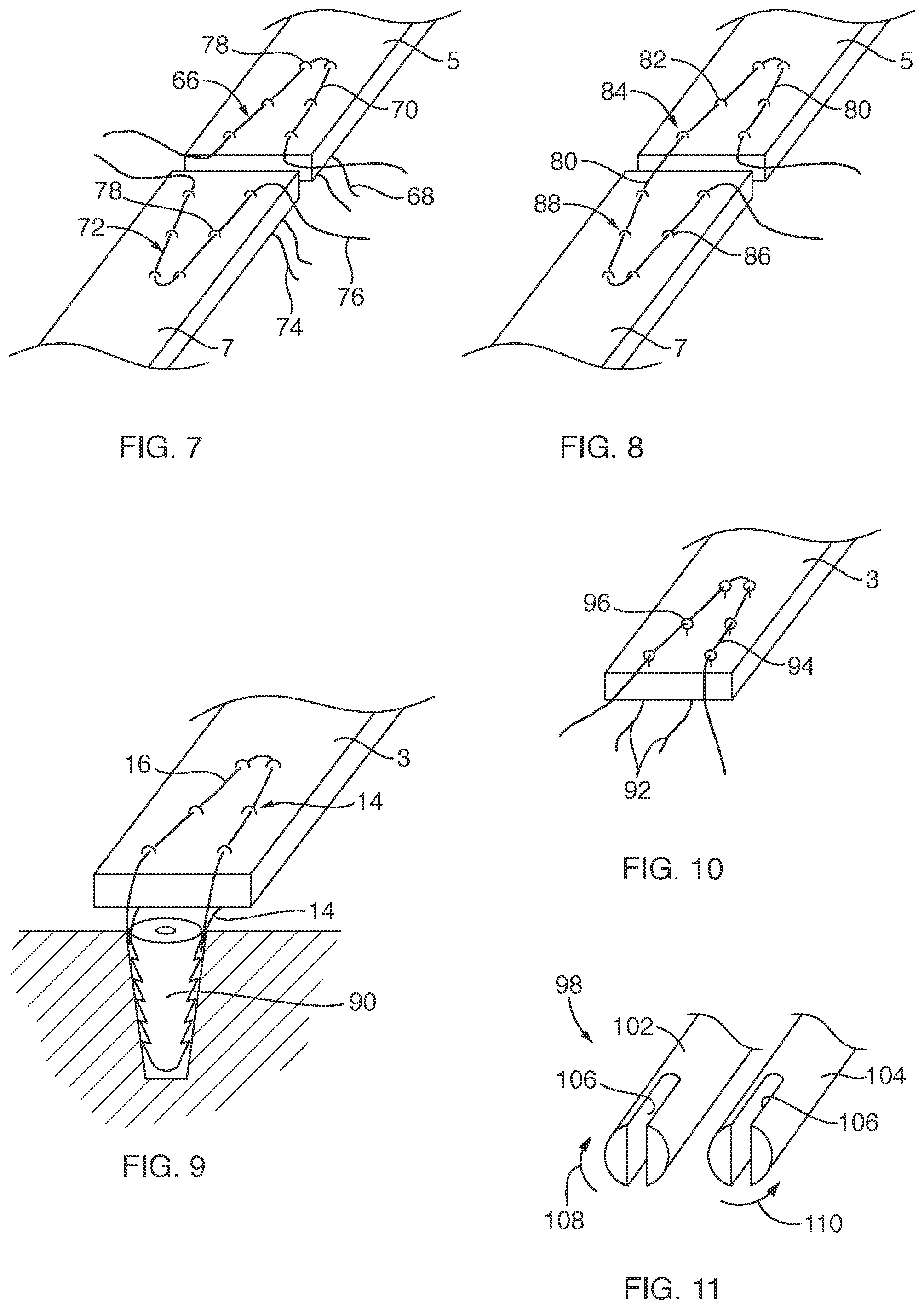 Patent US12167847 Figure 3 – Devices, systems, and methods for coupling flexible filament to soft tissue