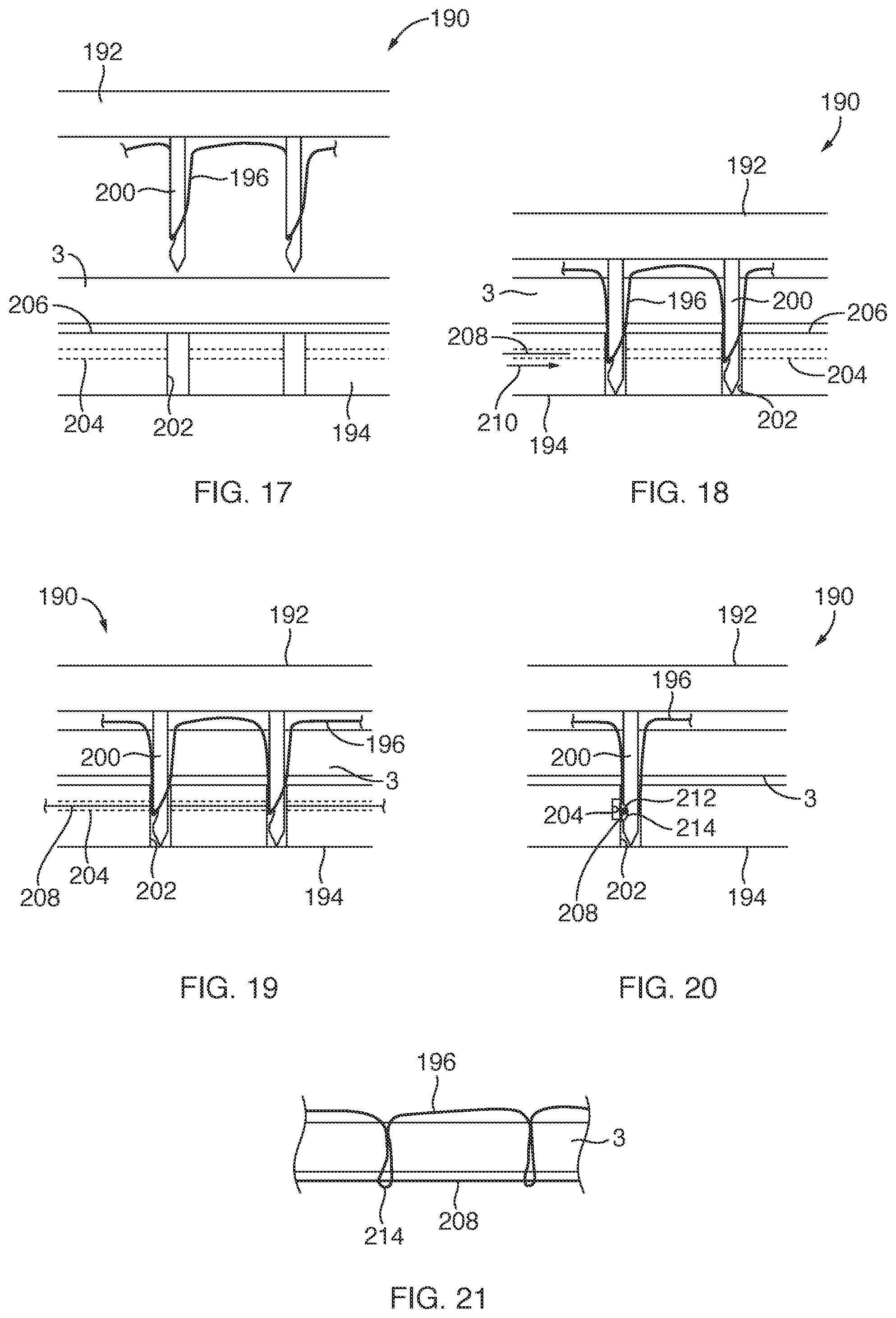 Patent US12167847 Figure 5 – Devices, systems, and methods for coupling flexible filament to soft tissue