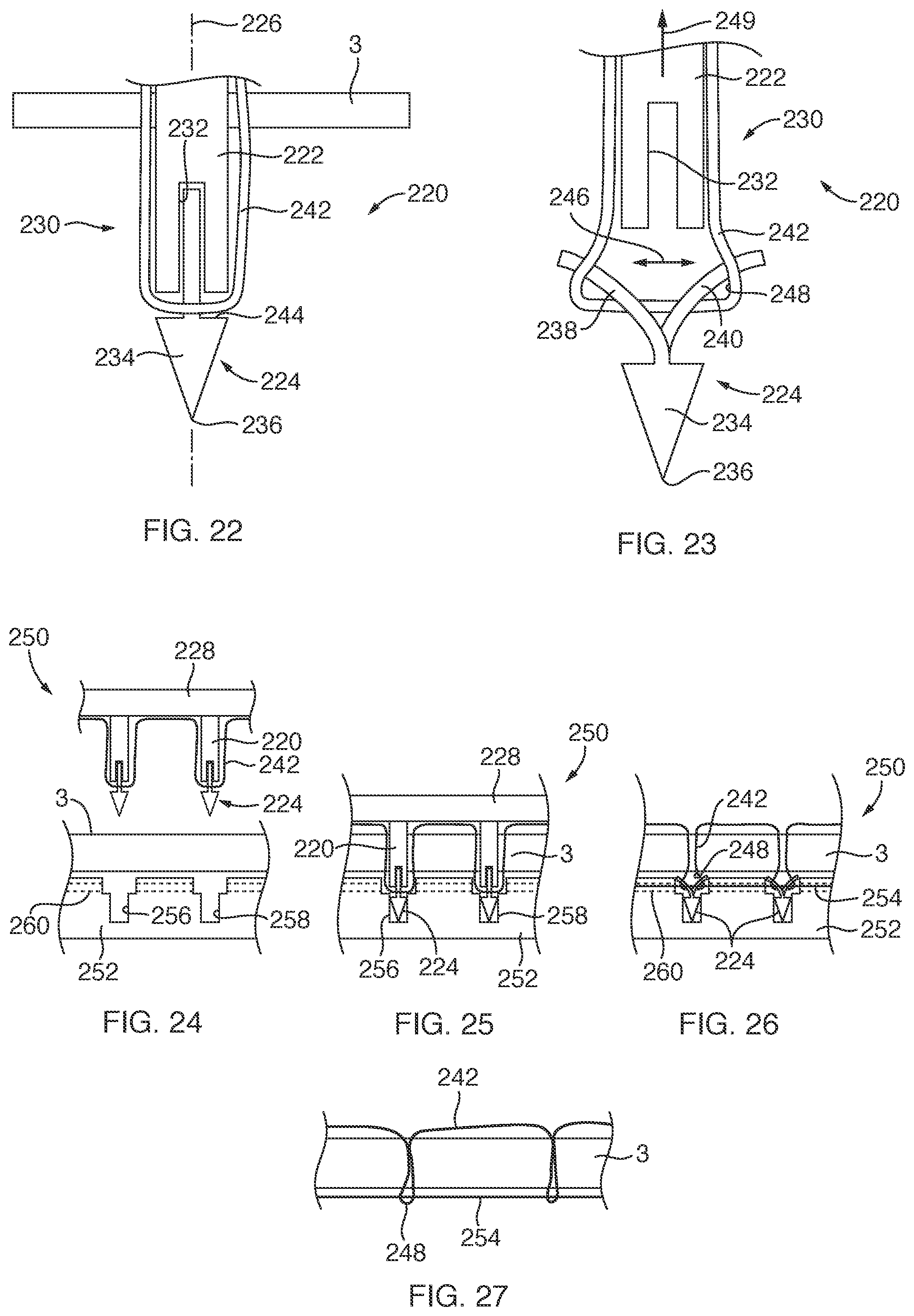 Patent US12167847 Figure 6 – Devices, systems, and methods for coupling flexible filament to soft tissue