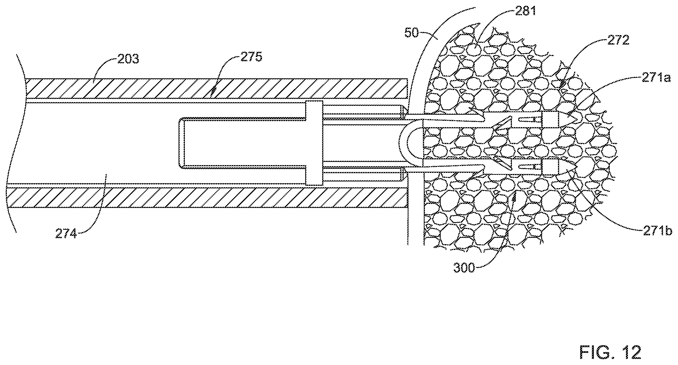 Patent US12167848 Figure 11 – Bone anchor delivery system