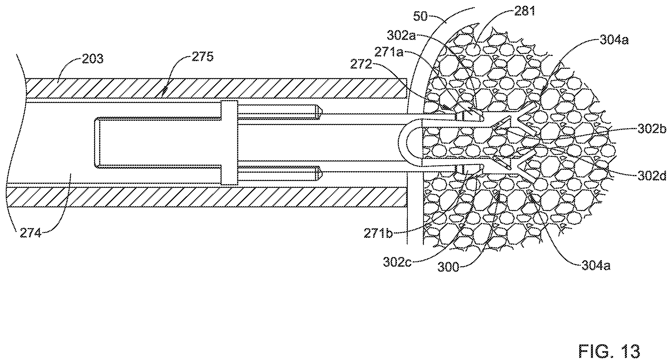 Patent US12167848 Figure 12 – Bone anchor delivery system