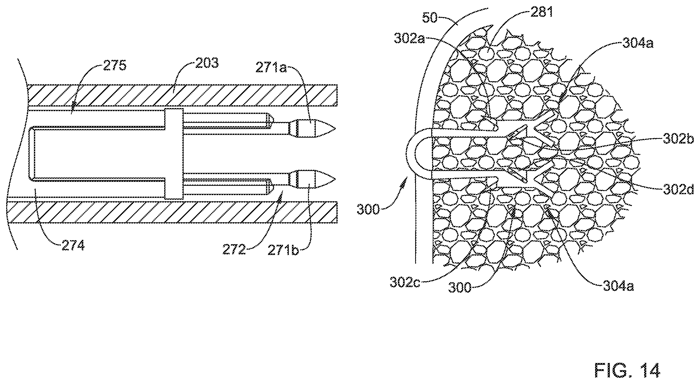Patent US12167848 Figure 13 – Bone anchor delivery system