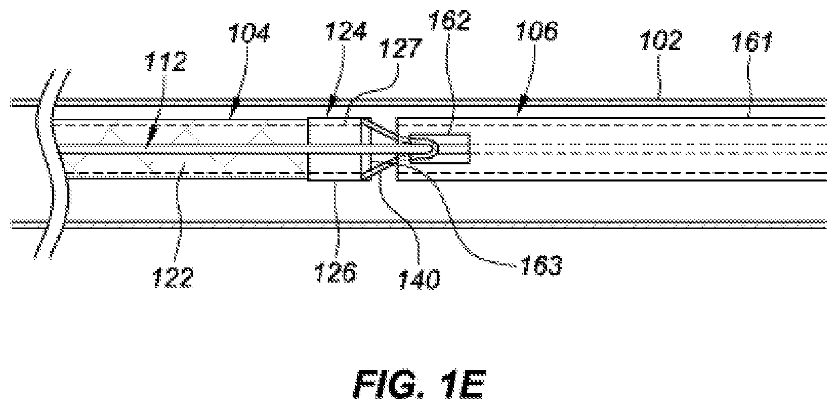 Patent US12167854 Figure 3 – Occlusive implants with fiber-based release structures