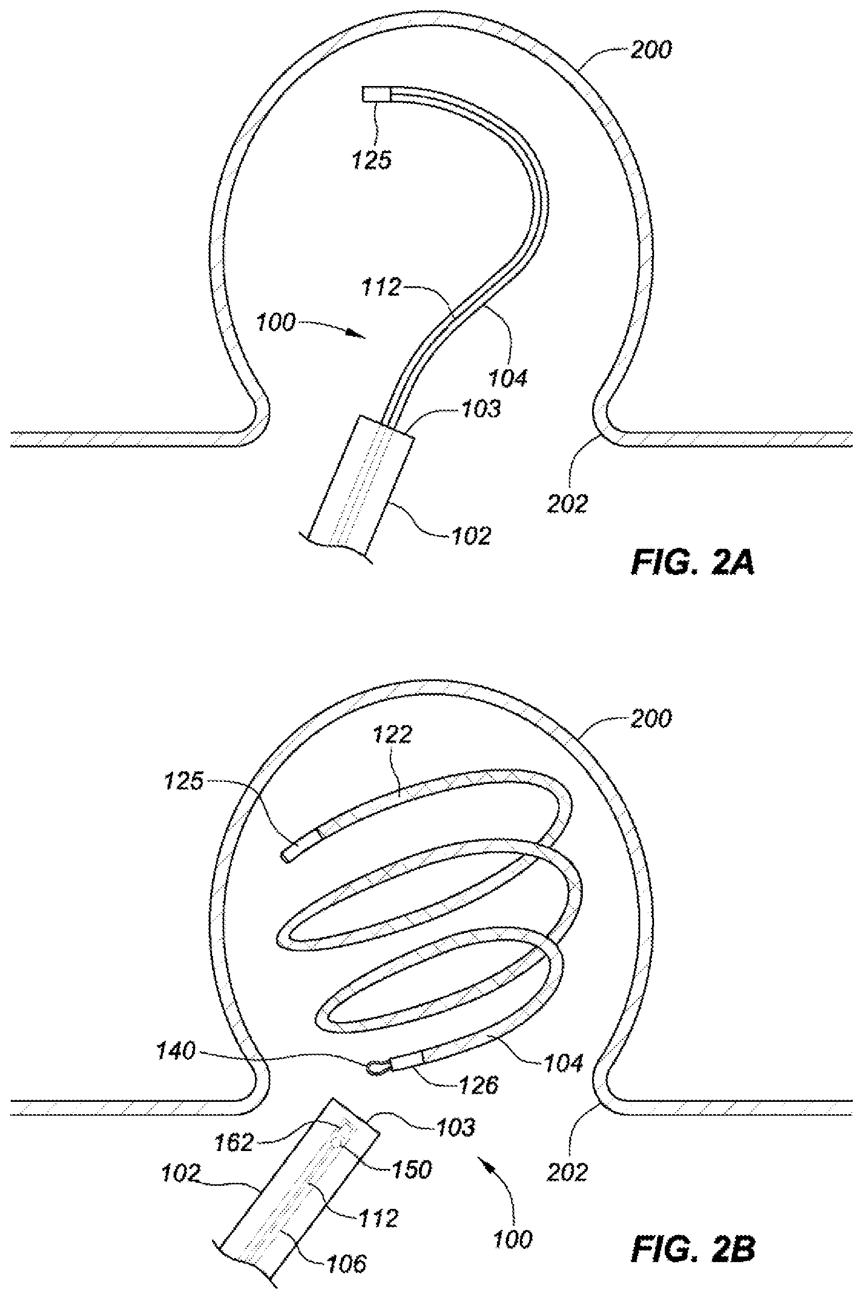 Patent US12167854 Figure 4 – Occlusive implants with fiber-based release structures