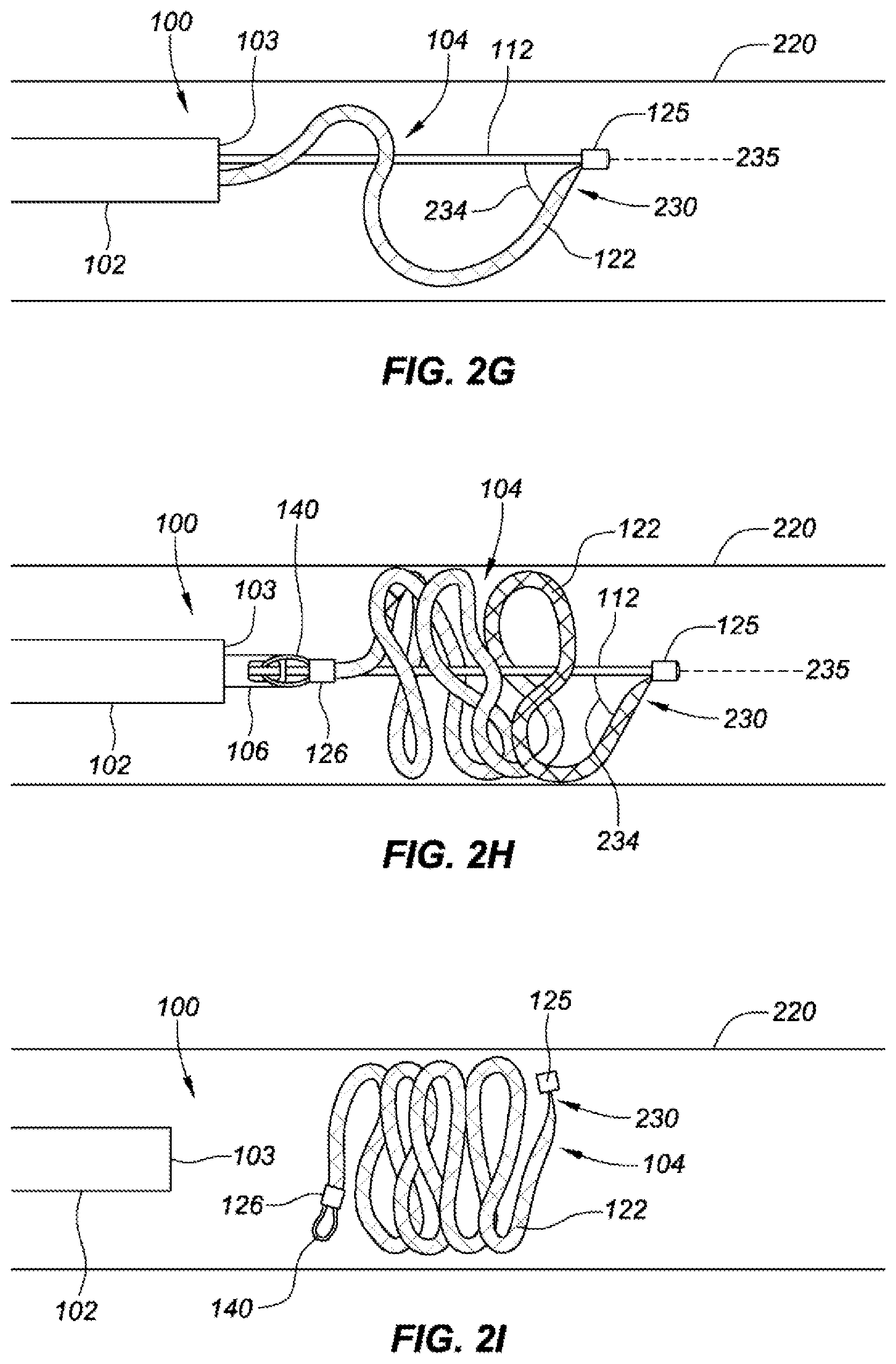 Patent US12167854 Figure 7 – Occlusive implants with fiber-based release structures