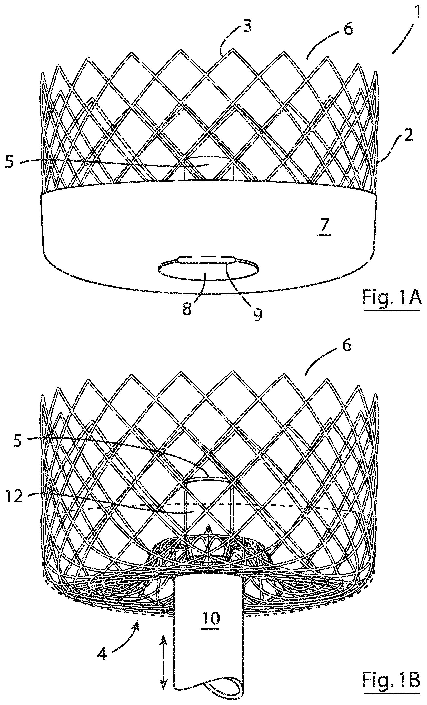 Patent US12167855 — Device for implantation in a left atrial appendage of the heart — Figure 1
