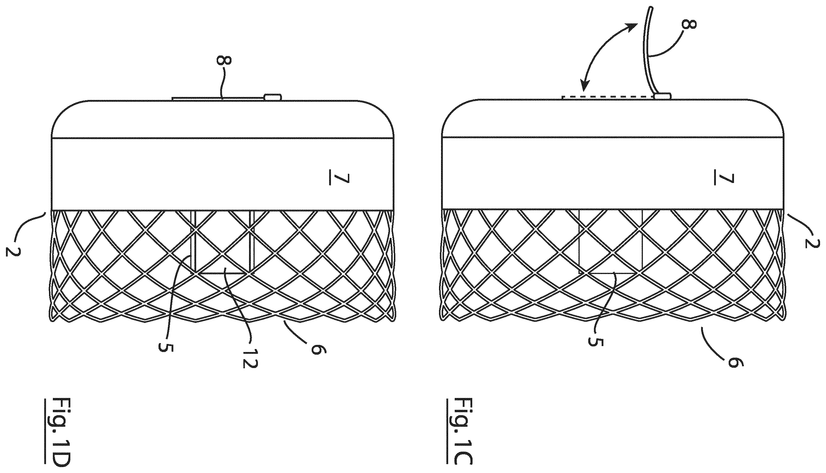 Patent US12167855 Figure 2 – Device for implantation in a left atrial appendage of the heart