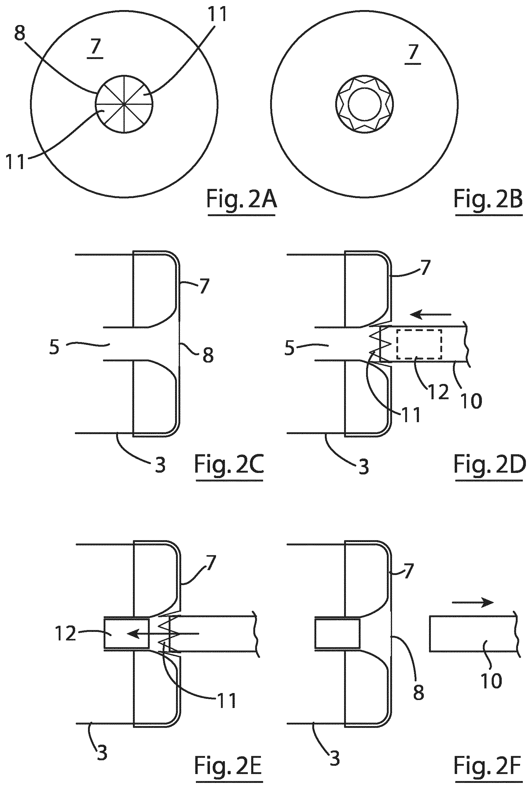 Patent US12167855 Figure 4 – Device for implantation in a left atrial appendage of the heart