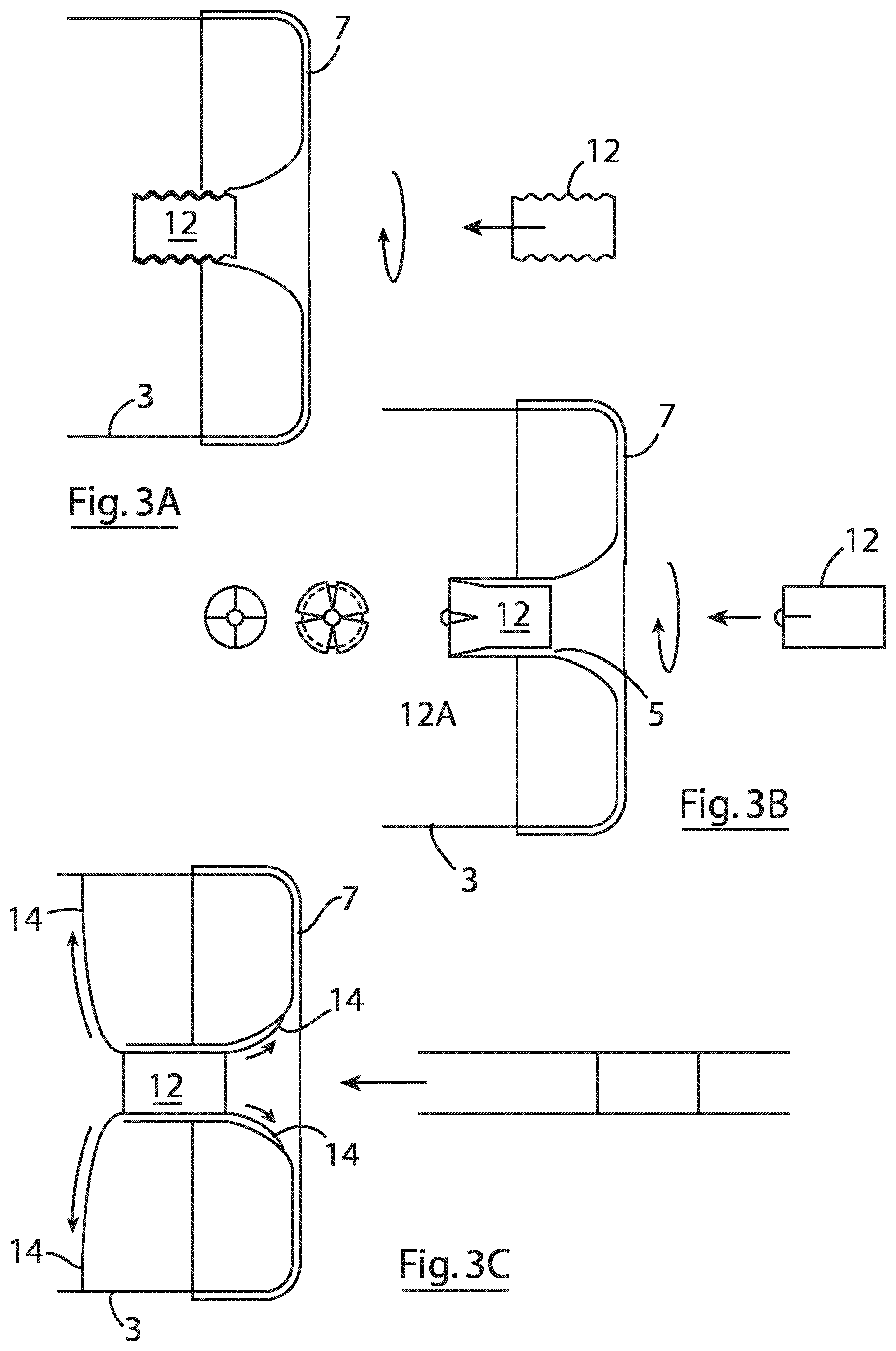 Patent US12167855 Figure 5 – Device for implantation in a left atrial appendage of the heart