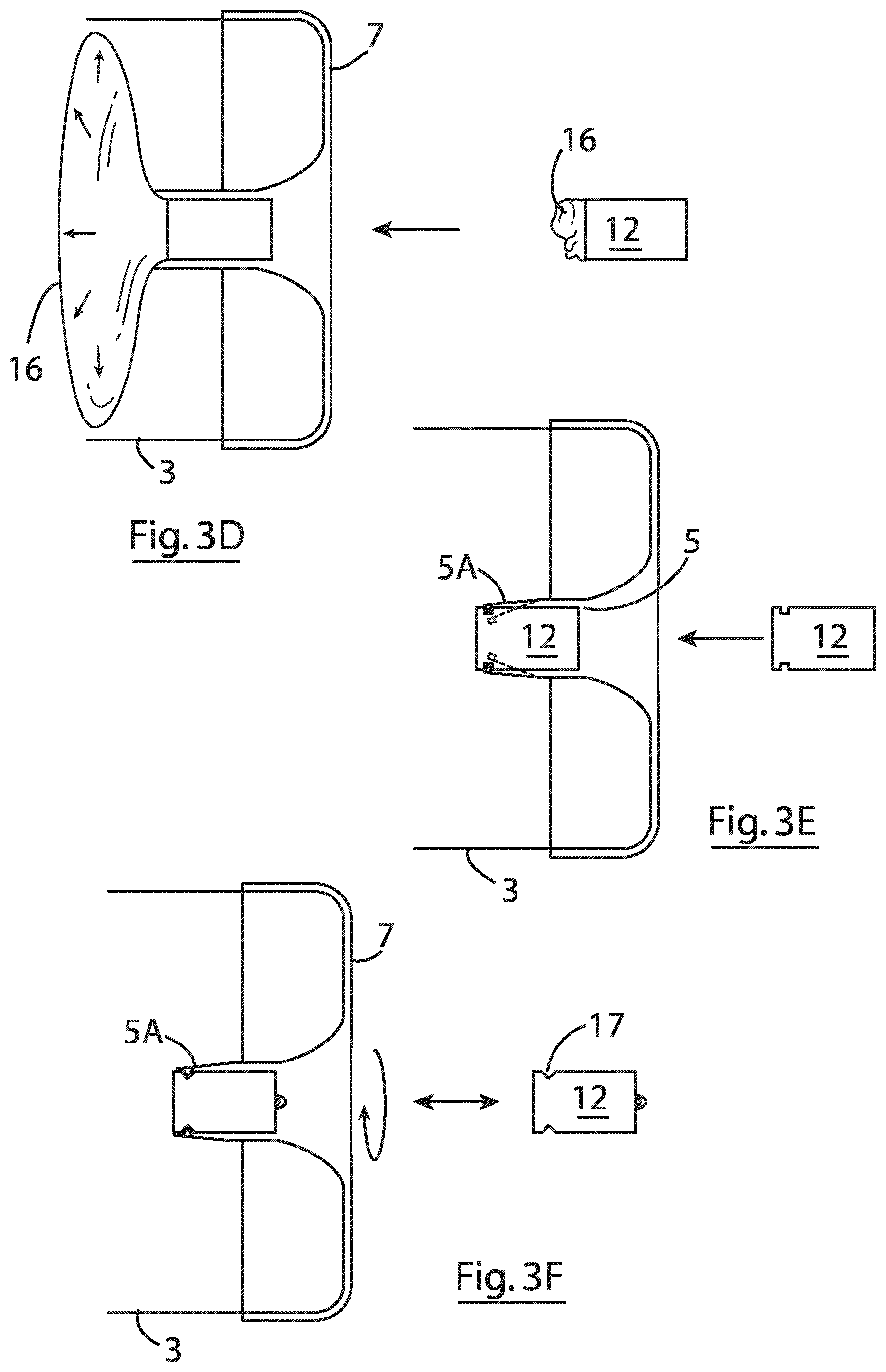 Patent US12167855 Figure 6 – Device for implantation in a left atrial appendage of the heart