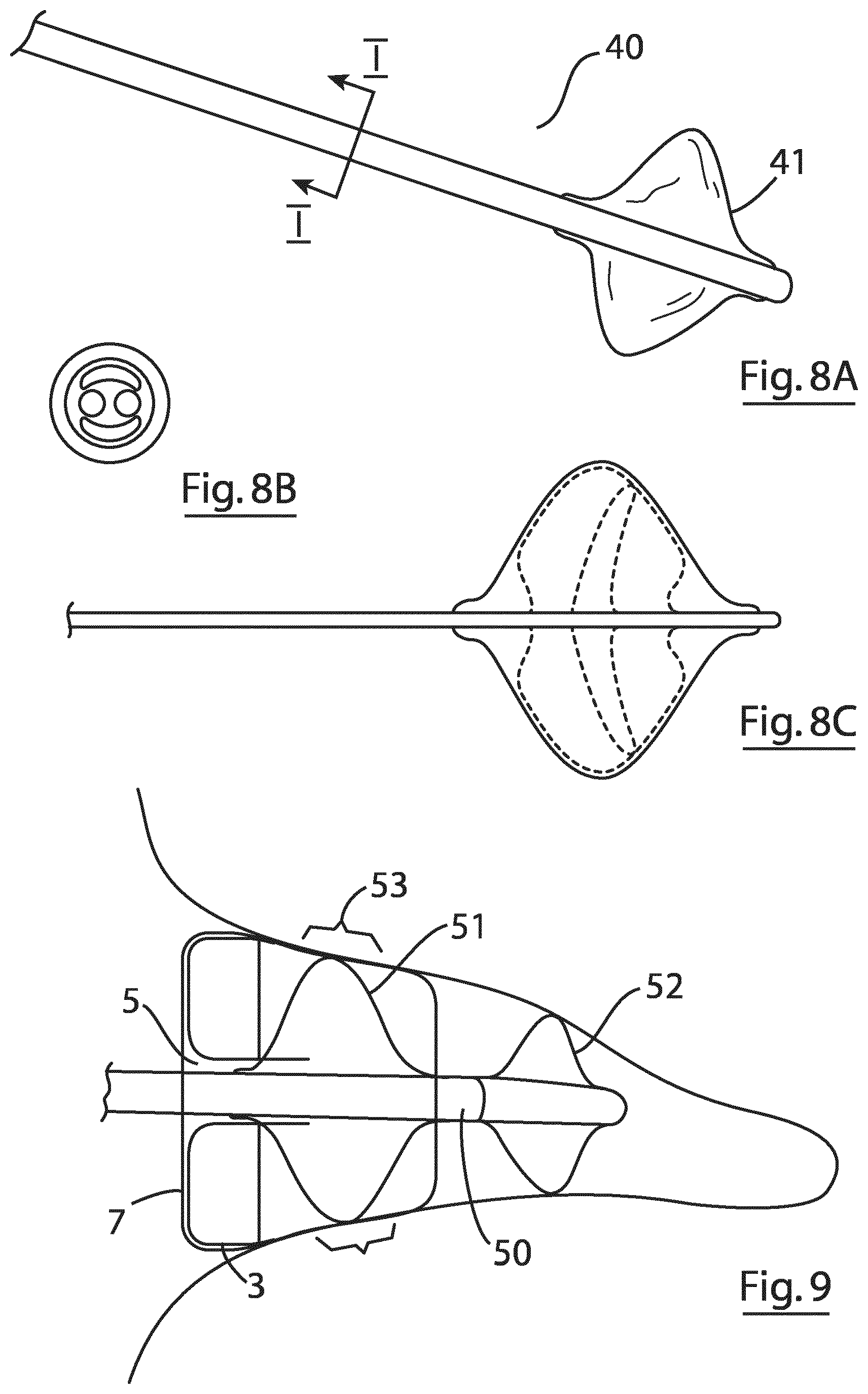Patent US12167855 Figure 10 – Device for implantation in a left atrial appendage of the heart