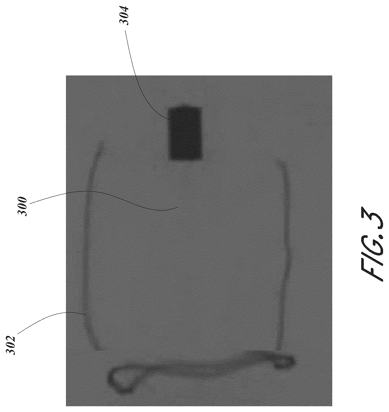 Patent US12167856 Figure 3 – Devices and methods for excluding the left atrial appendage